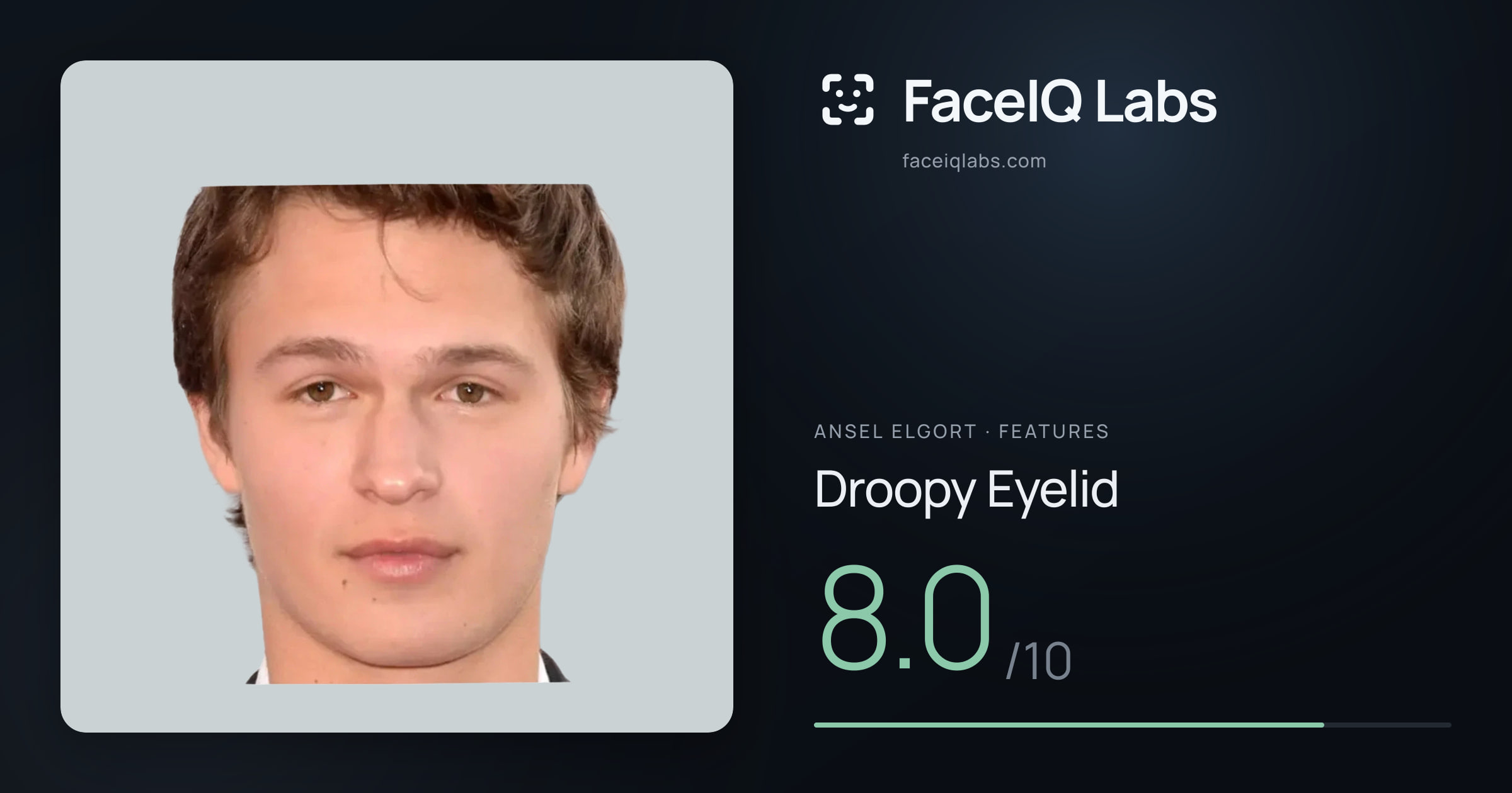 Ansel Elgort Droopy Eyelid: 8.0/10, drawn on the photo