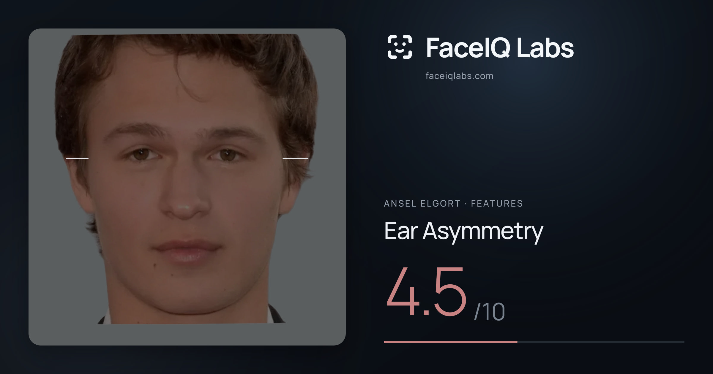 Ansel Elgort Ear Asymmetry: 4.5/10, drawn on the photo