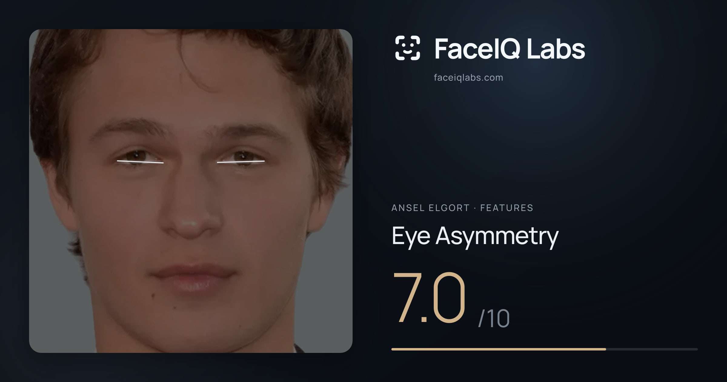 Ansel Elgort Eye Asymmetry: 7.0/10, drawn on the photo
