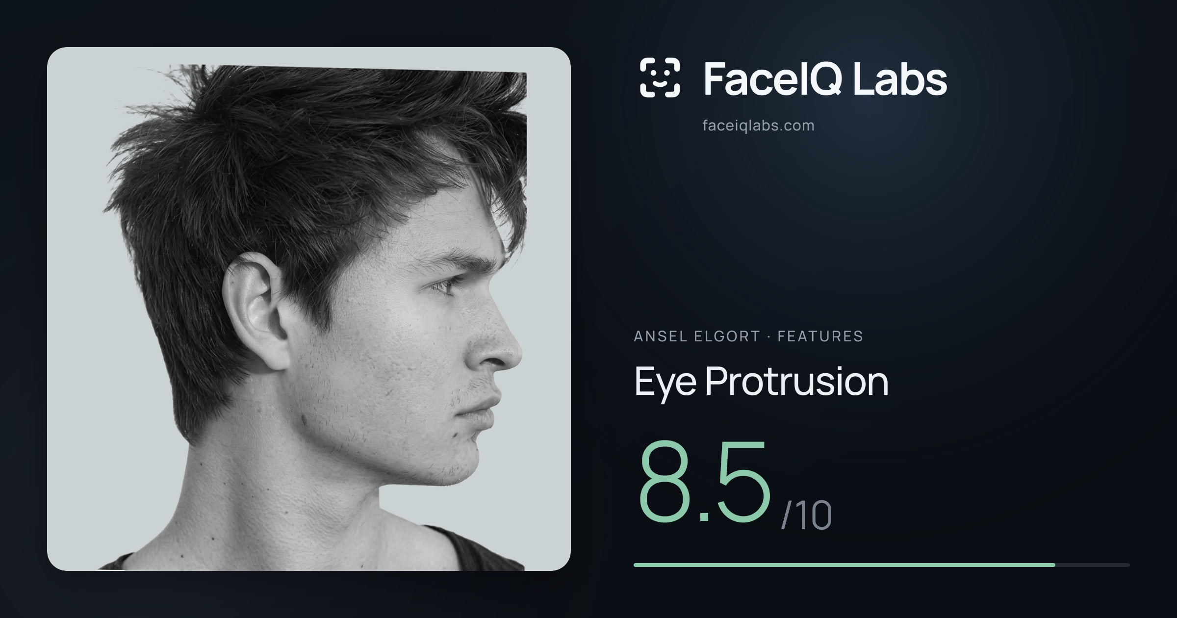 Ansel Elgort Eye Protrusion: 8.5/10, drawn on the photo