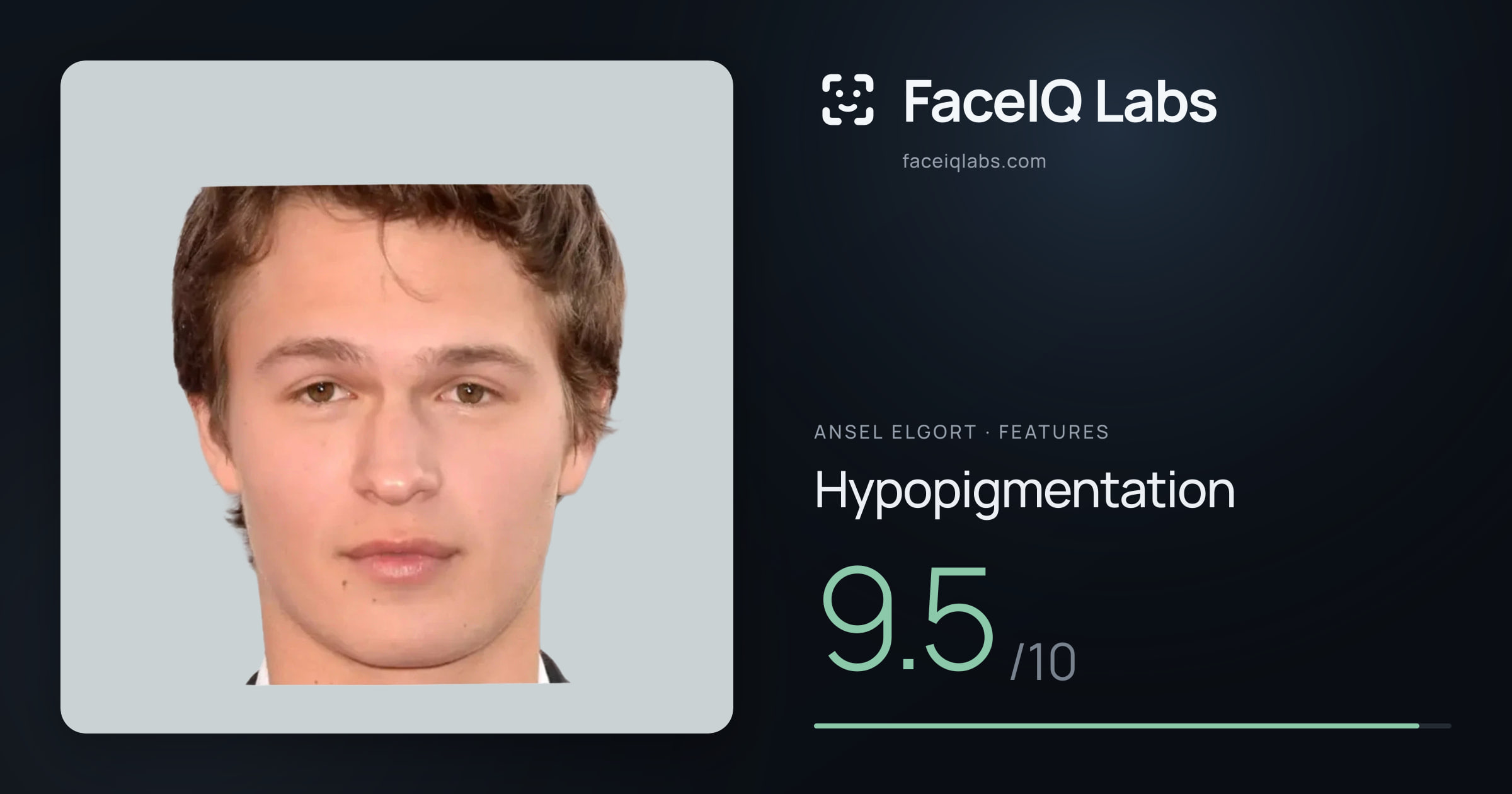 Ansel Elgort Hypopigmentation: 9.5/10, drawn on the photo