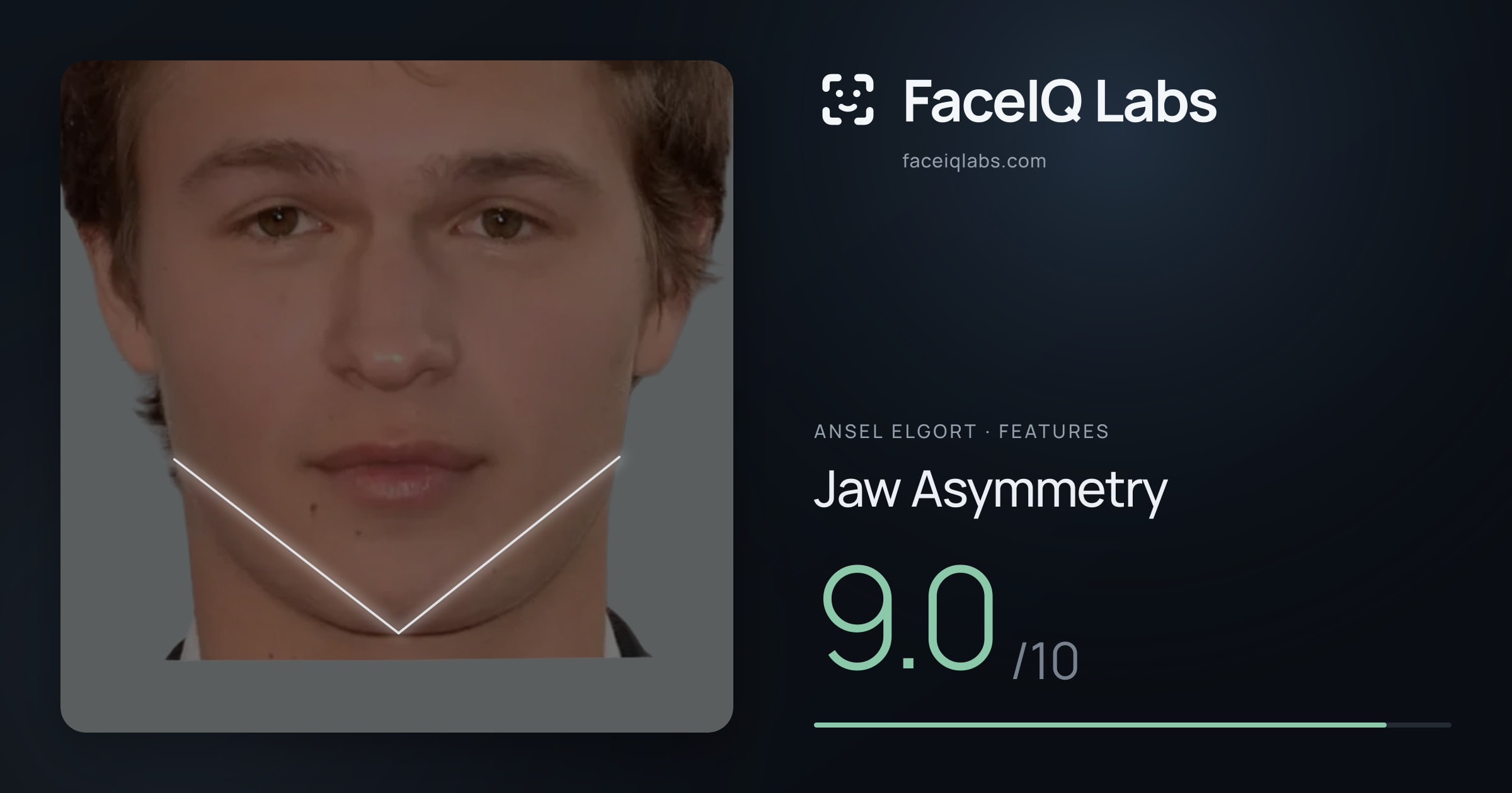 Ansel Elgort Jaw Asymmetry: 9.0/10, drawn on the photo