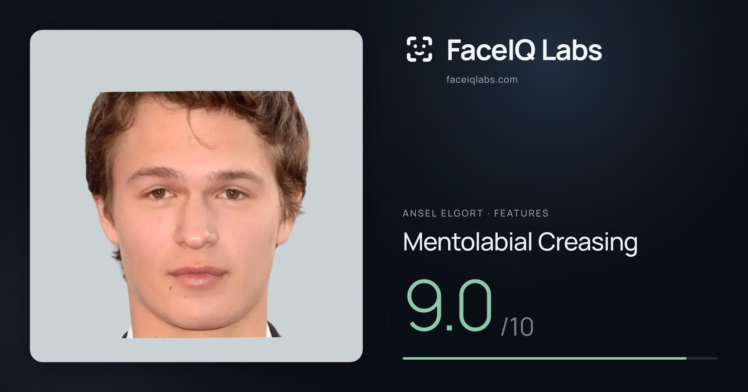 Ansel Elgort Mentolabial Creasing: 9.0/10, drawn on the photo
