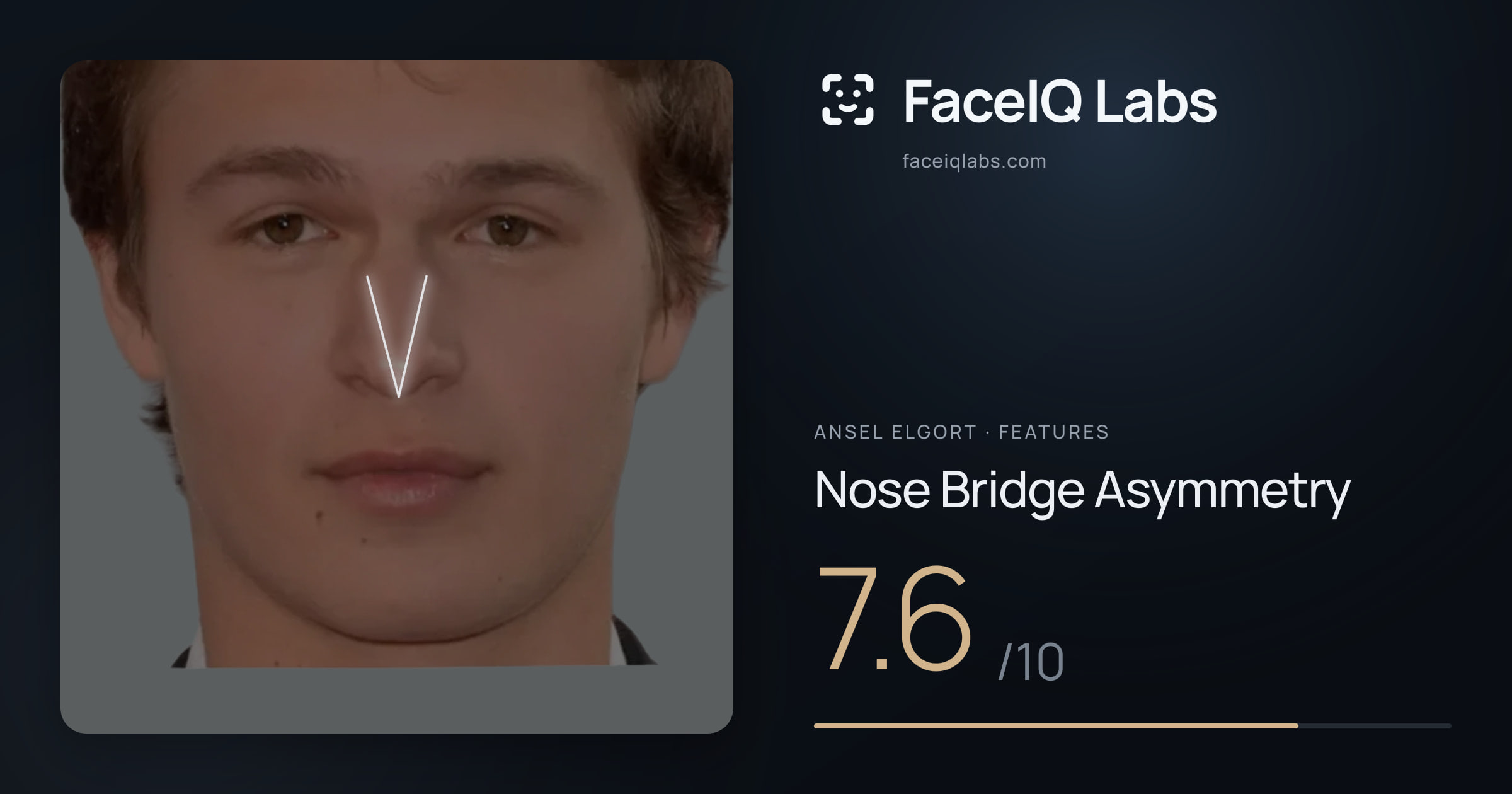 Ansel Elgort Nose Bridge Asymmetry: 7.6/10, drawn on the photo