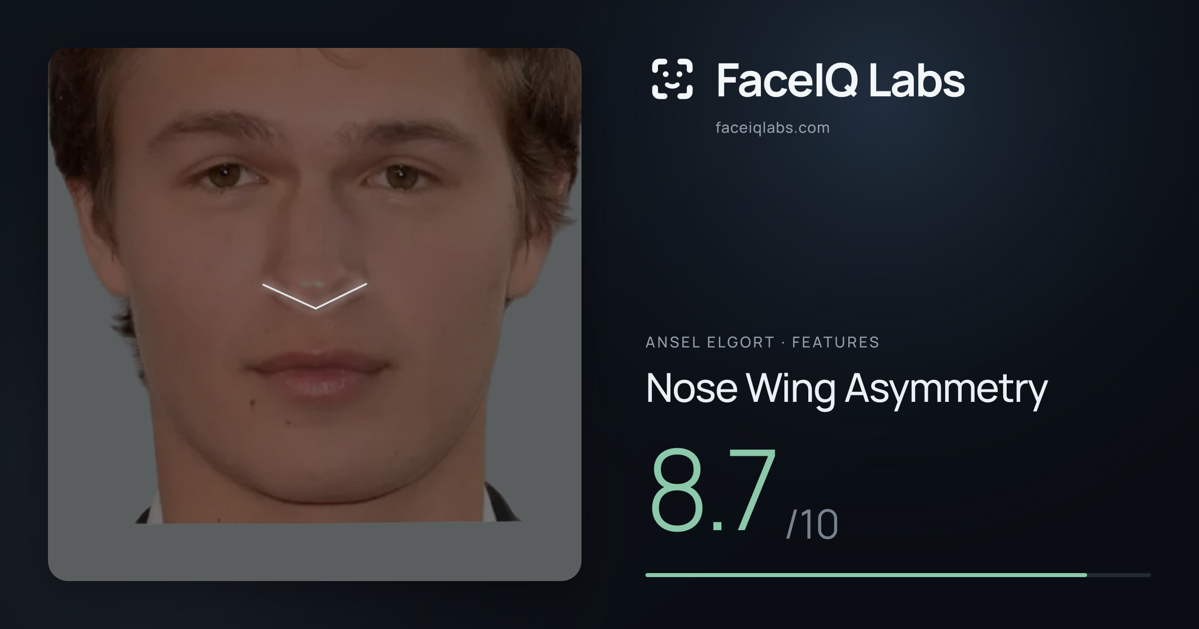 Ansel Elgort Nose Wing Asymmetry: 8.7/10, drawn on the photo