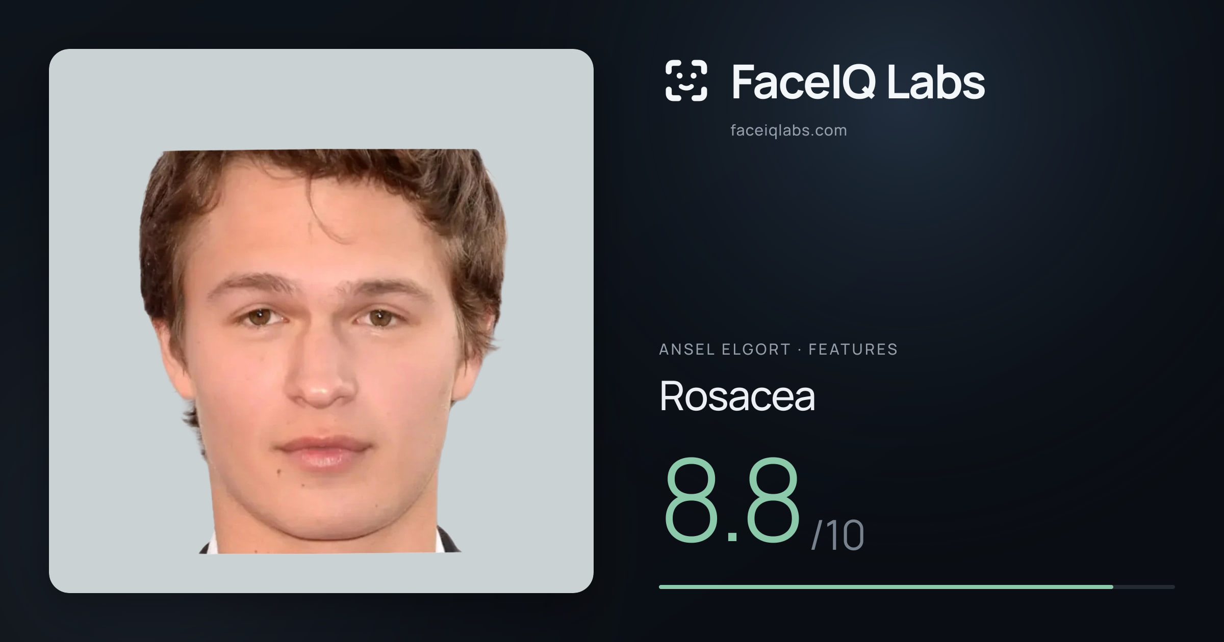 Ansel Elgort Rosacea: 8.8/10, drawn on the photo