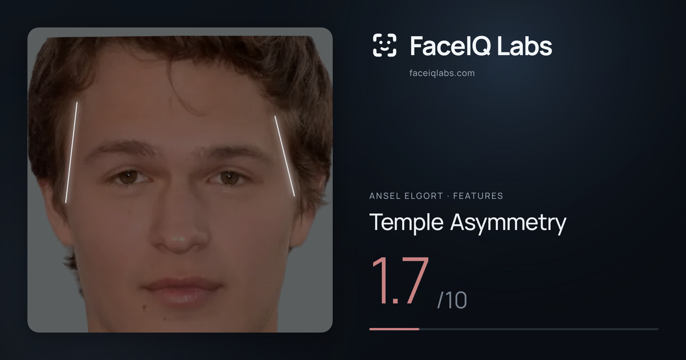 Ansel Elgort Temple Asymmetry: 1.7/10, drawn on the photo