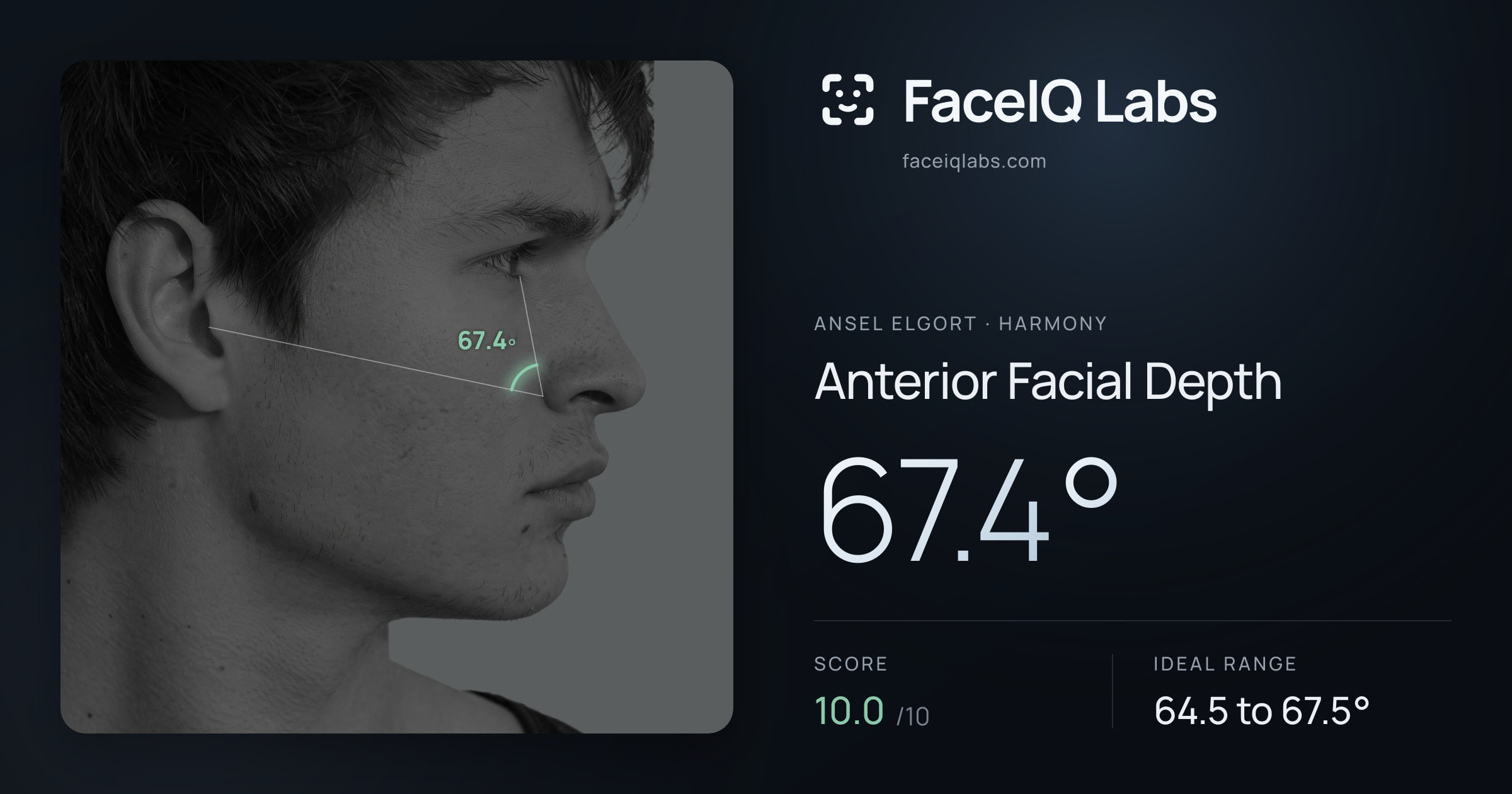 Ansel Elgort Anterior Facial Depth: 67.4°, drawn on the photo