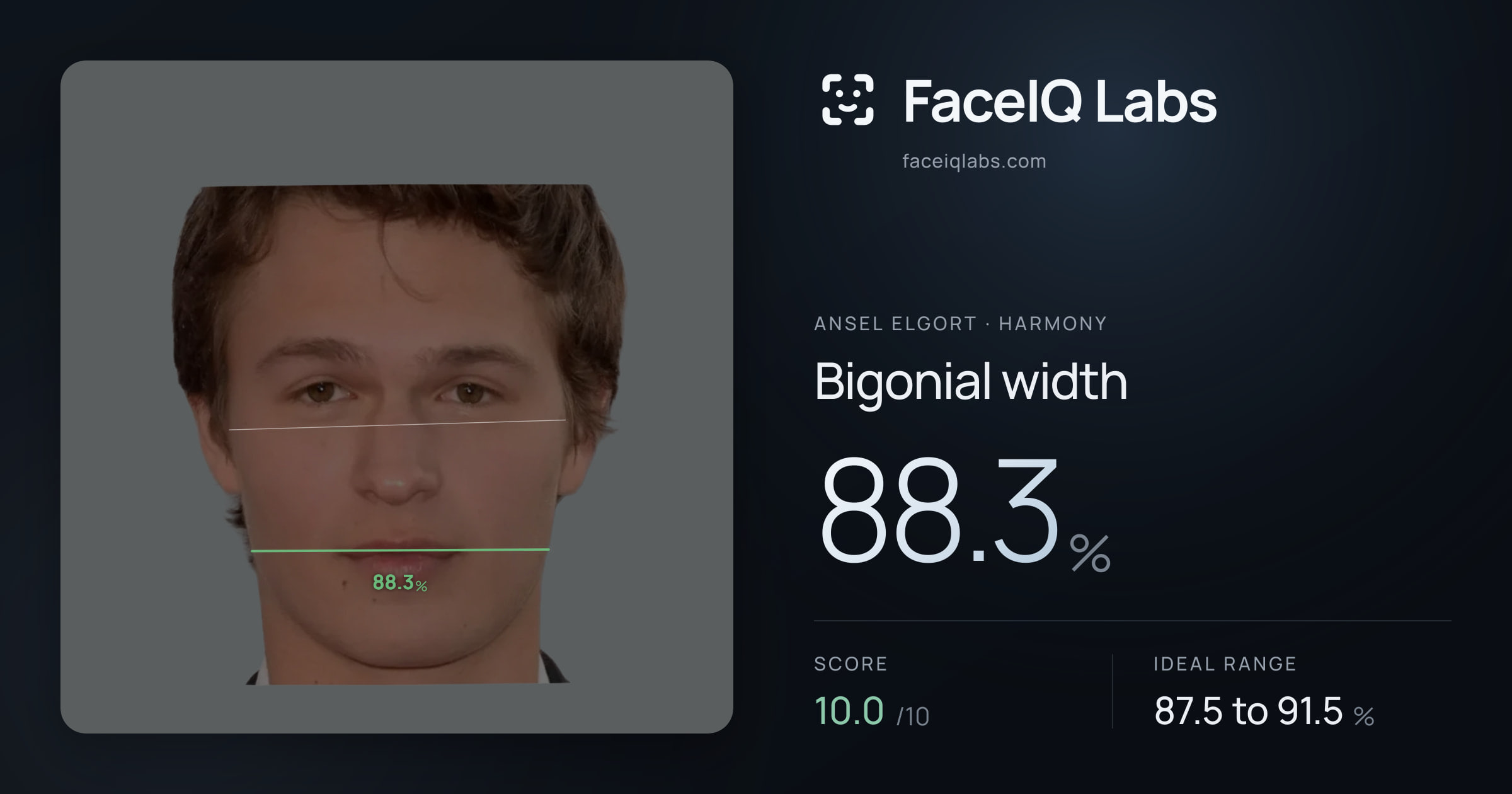 Ansel Elgort Bigonial width: 88.3%, drawn on the photo