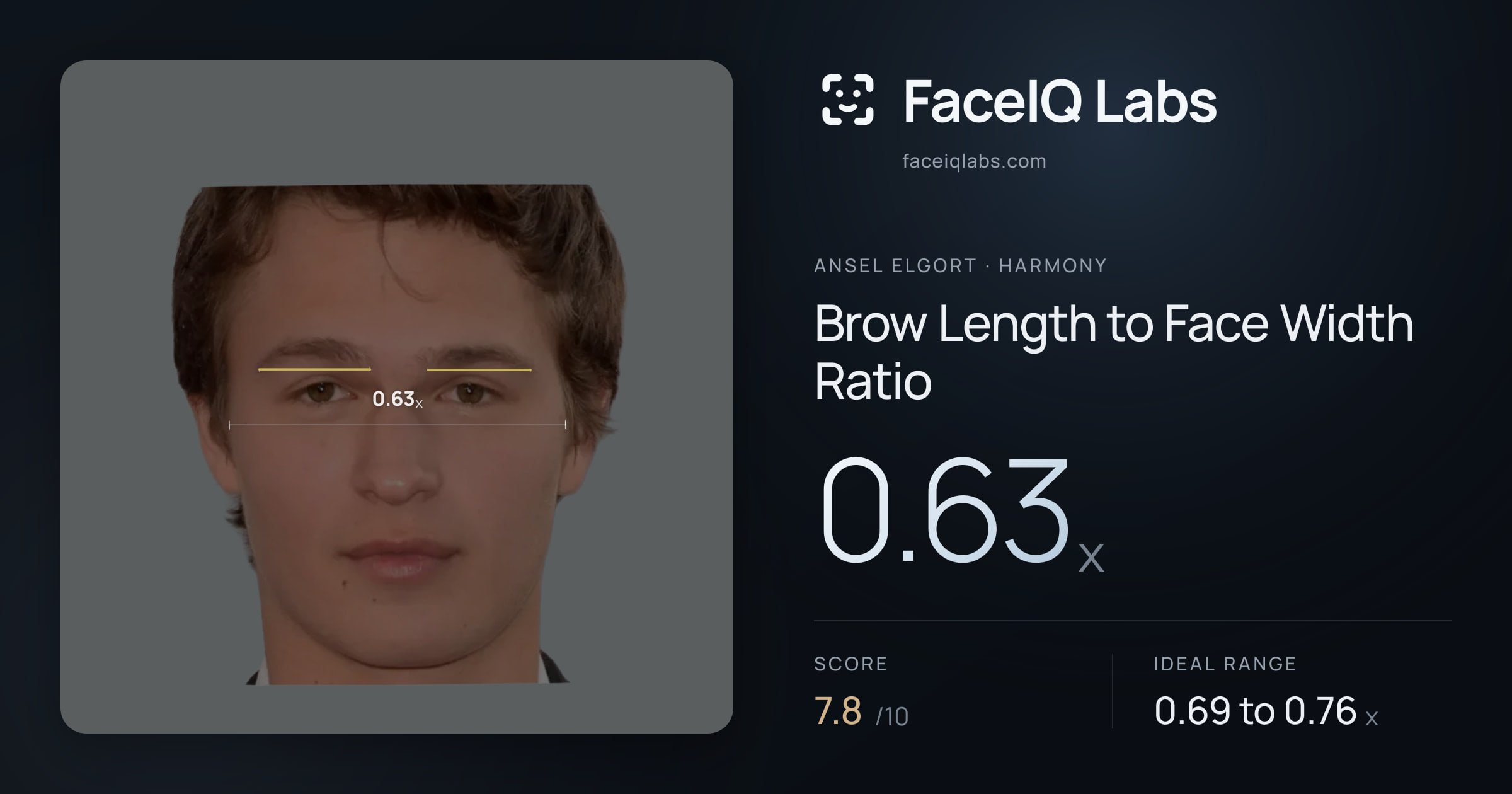 Ansel Elgort Brow Length to Face Width Ratio: 0.63x, drawn on the photo