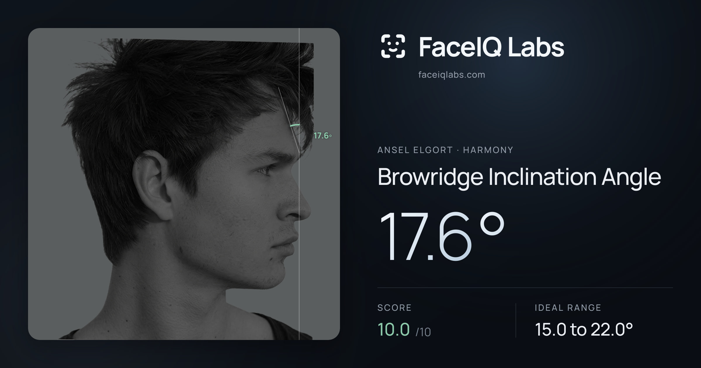 Ansel Elgort Browridge Inclination Angle: 17.6°, drawn on the photo