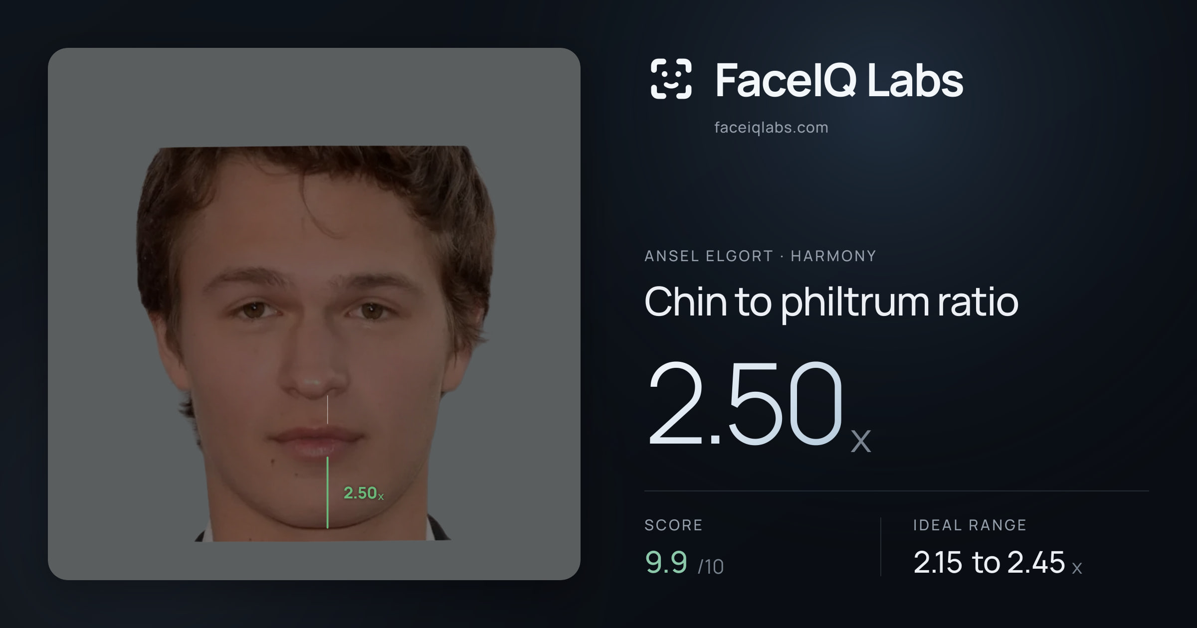 Ansel Elgort Chin to philtrum ratio: 2.50x, drawn on the photo