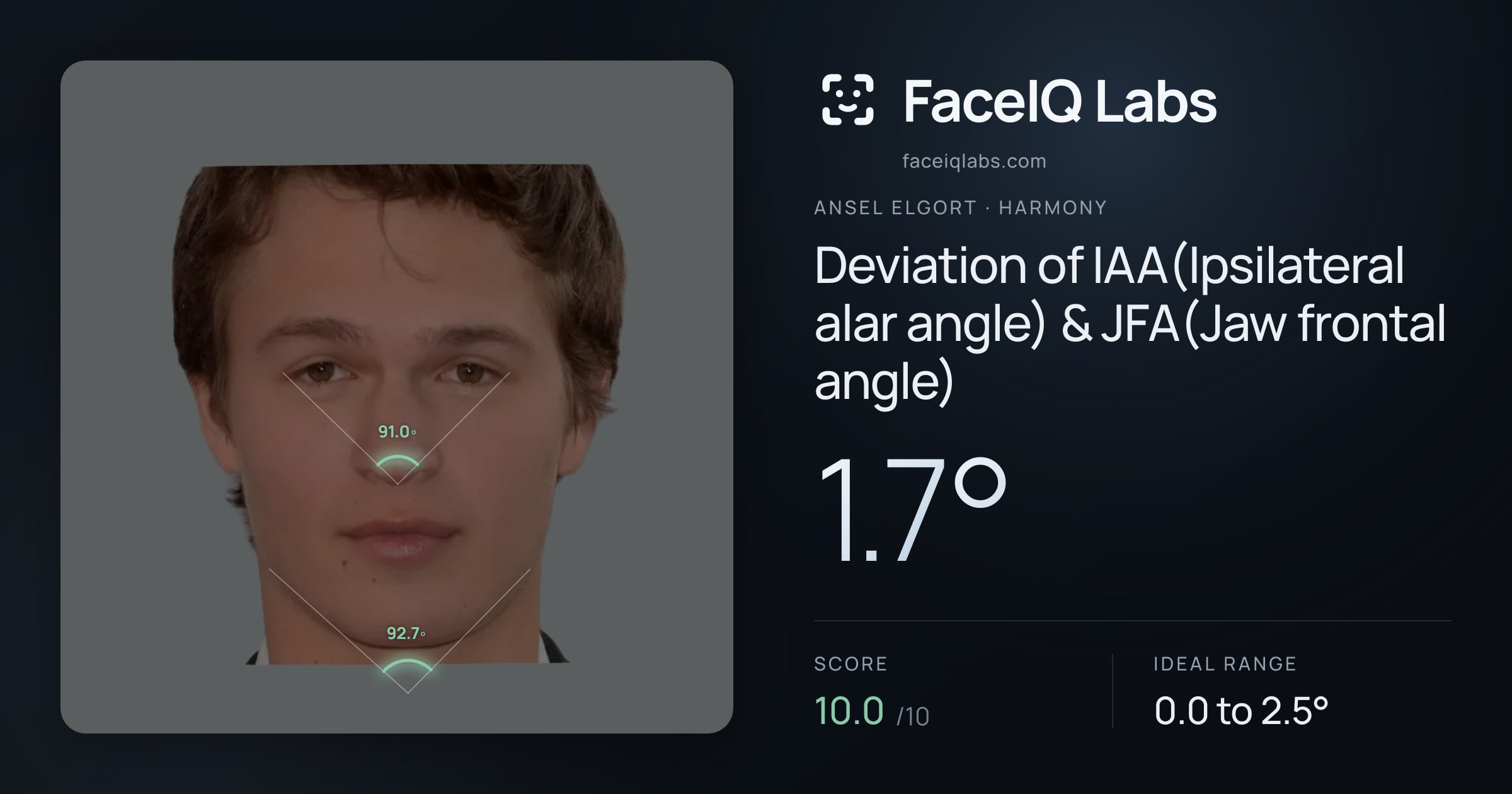 Ansel Elgort Deviation of IAA(Ipsilateral alar angle) & JFA(Jaw frontal angle): 1.7°, drawn on the photo