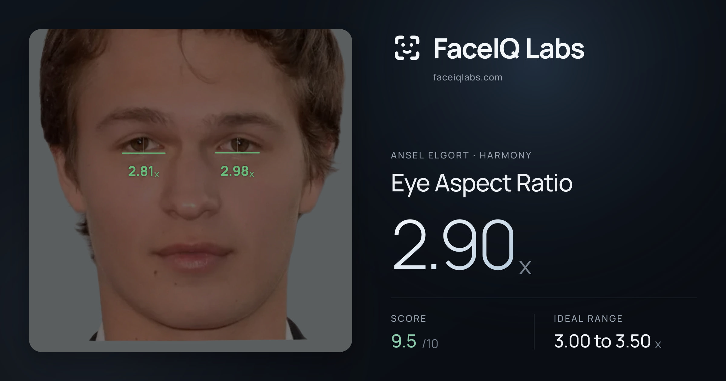Ansel Elgort Eye Aspect Ratio: 2.90x, drawn on the photo