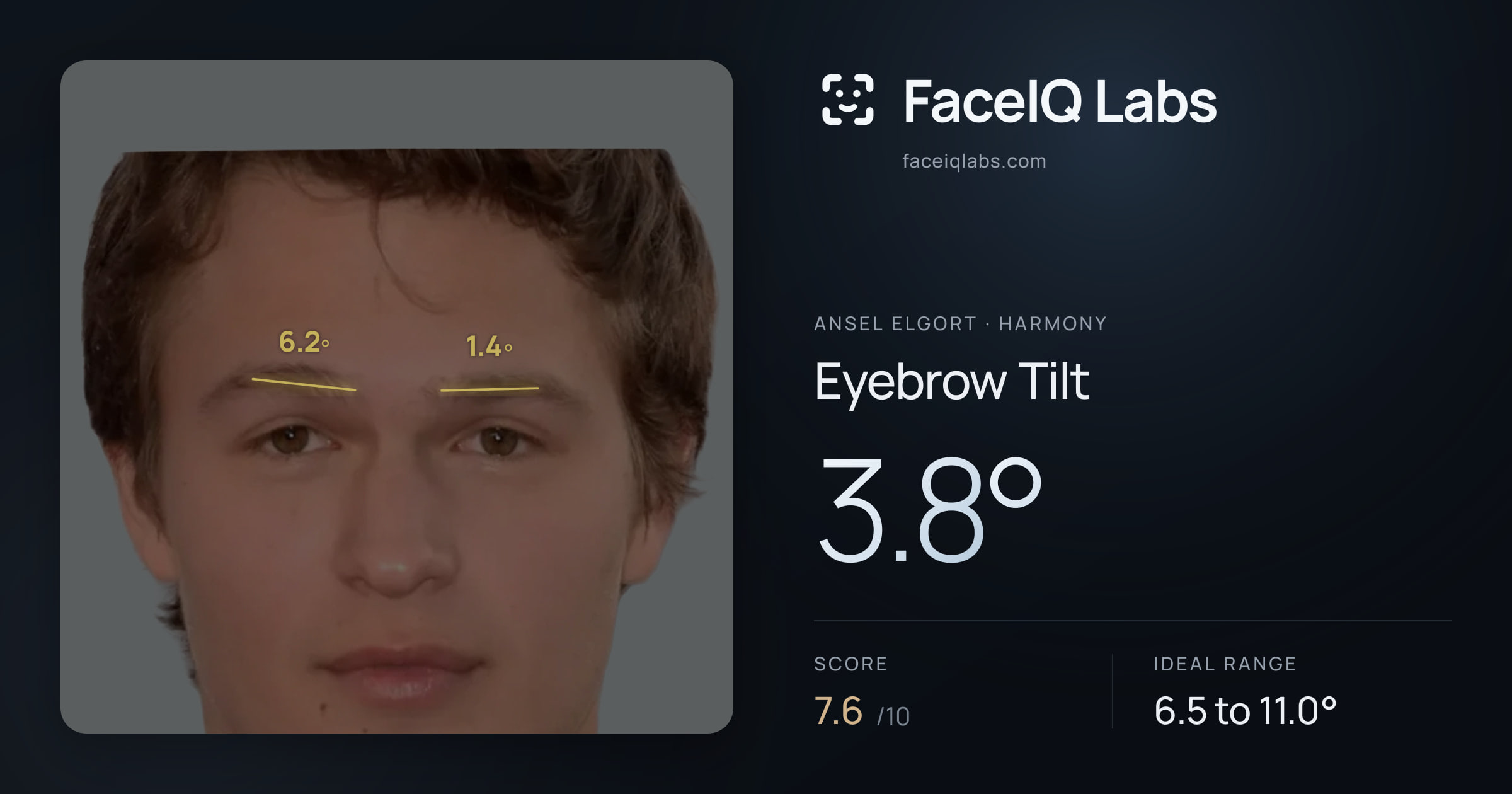 Ansel Elgort Eyebrow Tilt: 3.8°, drawn on the photo