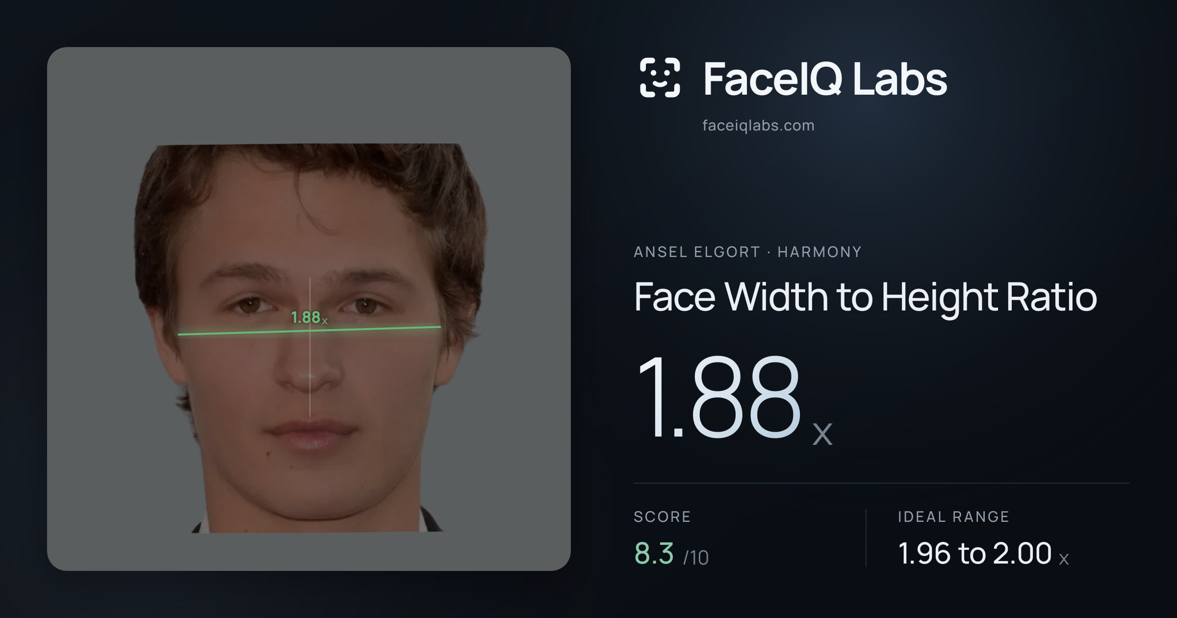 Ansel Elgort Face Width to Height Ratio: 1.88x, drawn on the photo