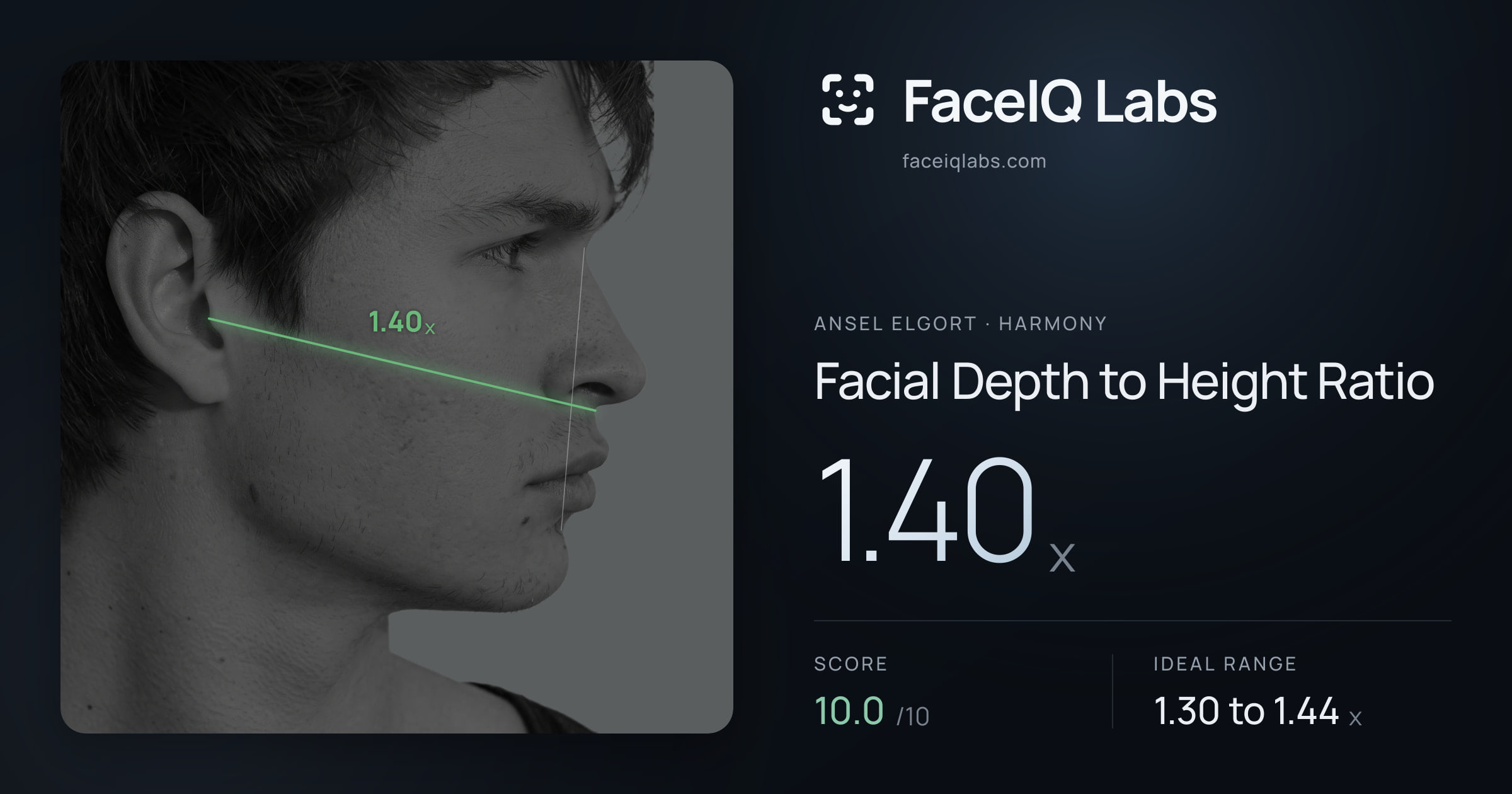 Ansel Elgort Facial Depth to Height Ratio: 1.40x, drawn on the photo