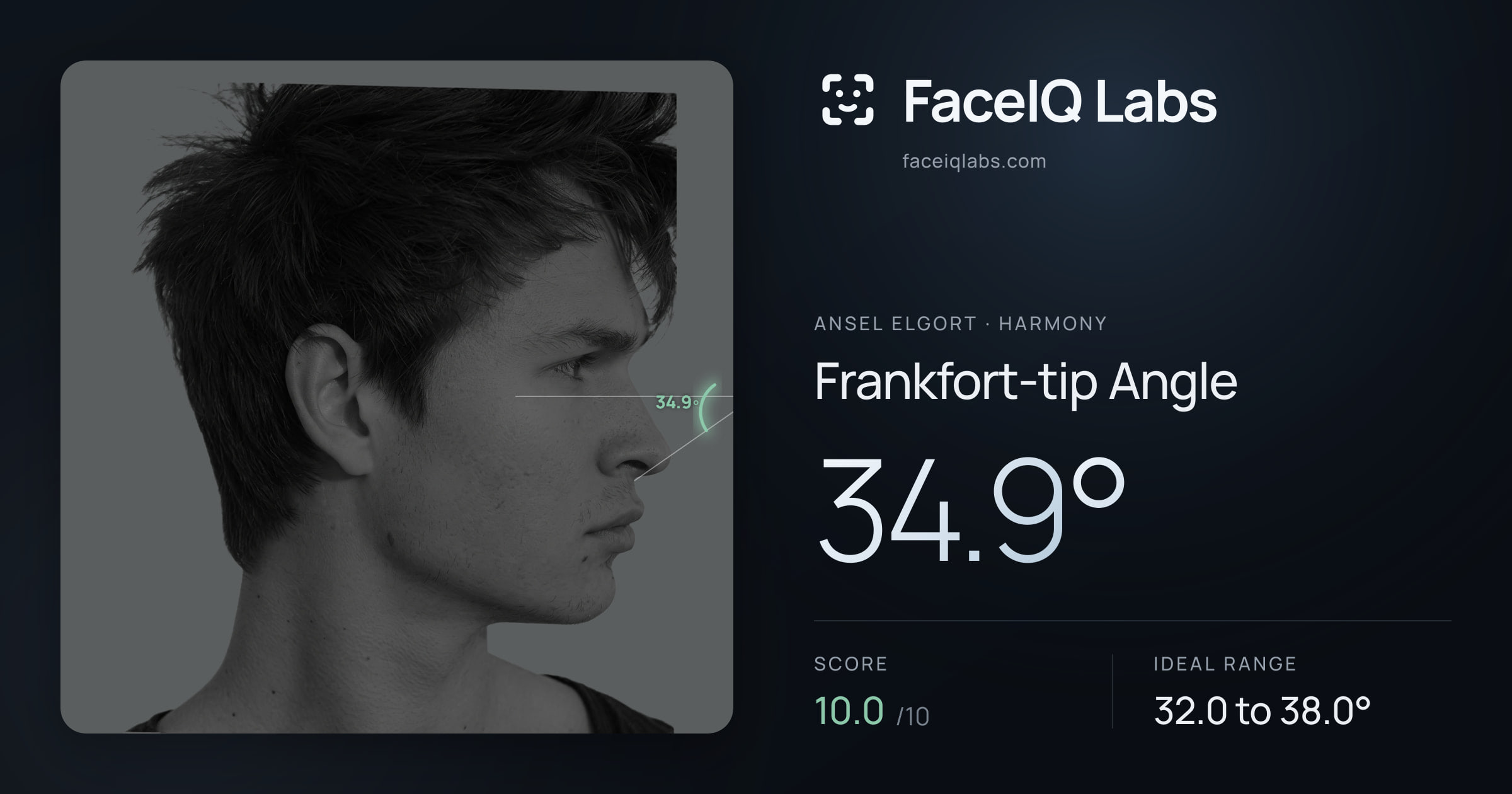 Ansel Elgort Frankfort-tip Angle: 34.9°, drawn on the photo