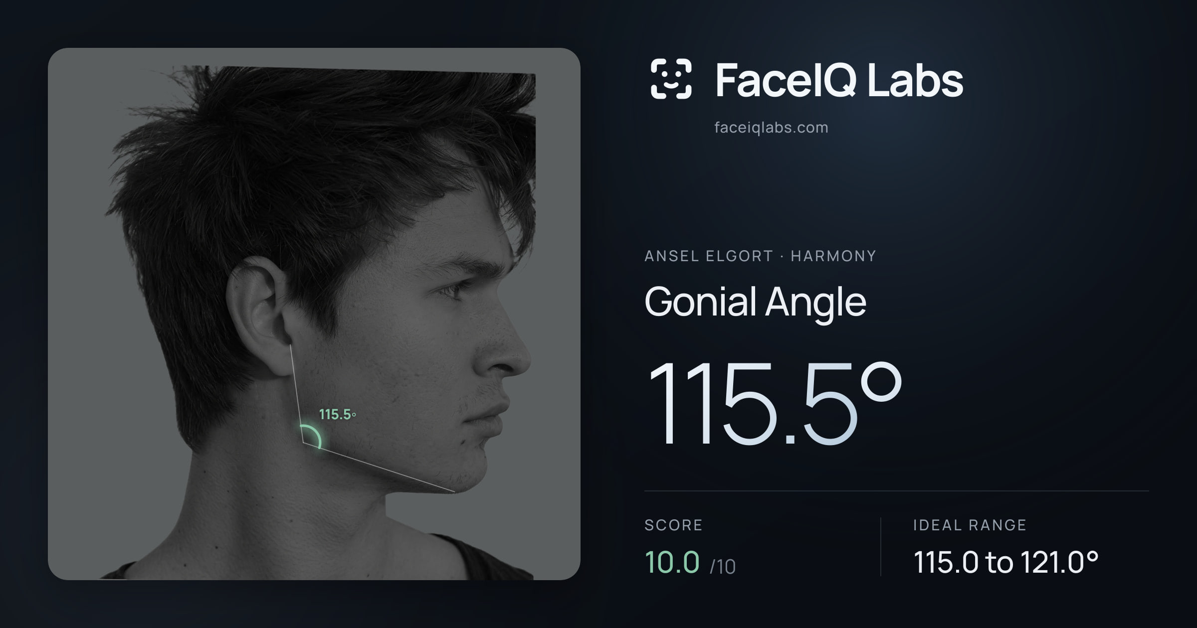 Ansel Elgort Gonial Angle: 115.5°, drawn on the photo