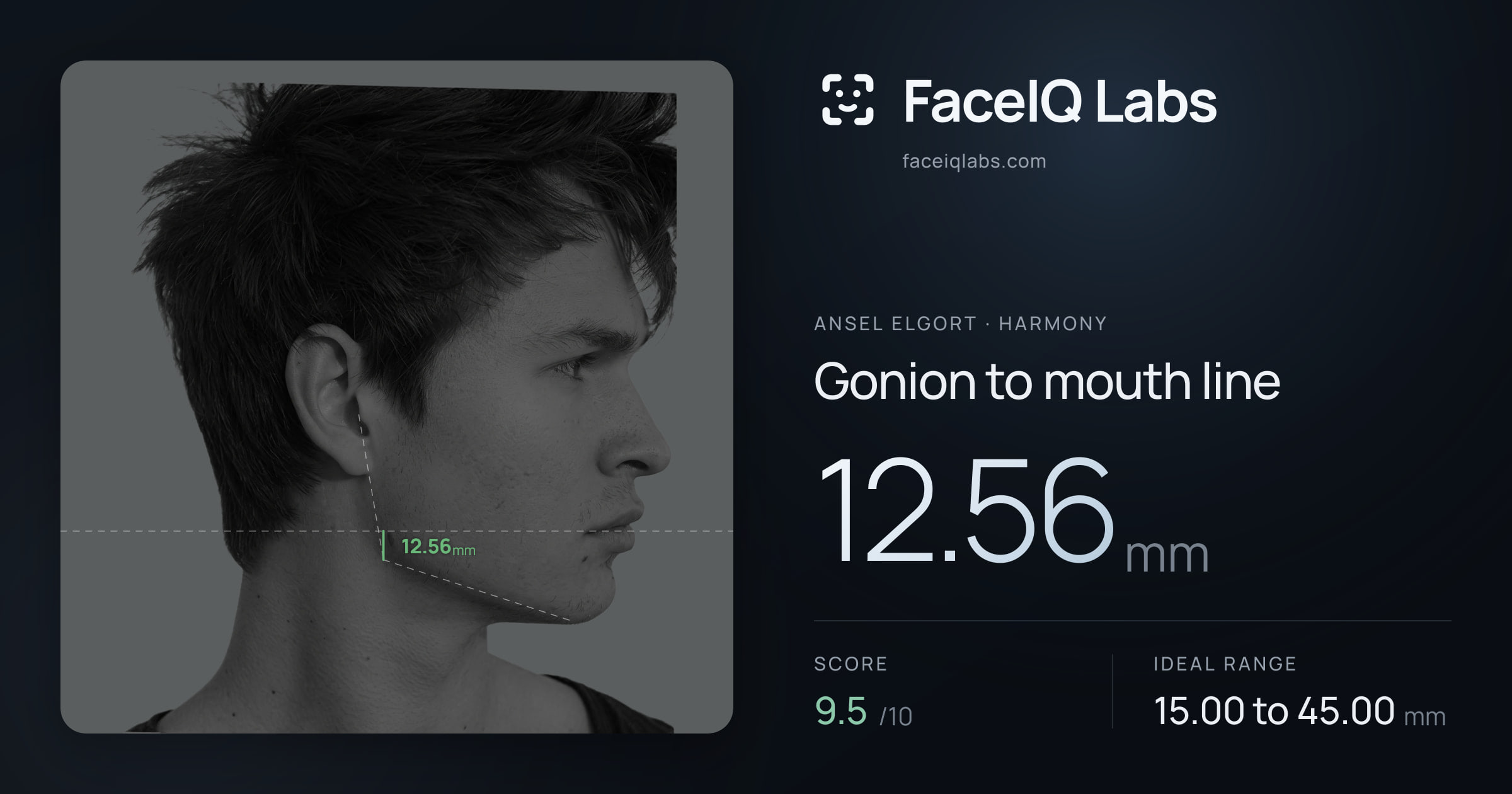 Ansel Elgort Gonion to mouth line: 12.56mm, drawn on the photo