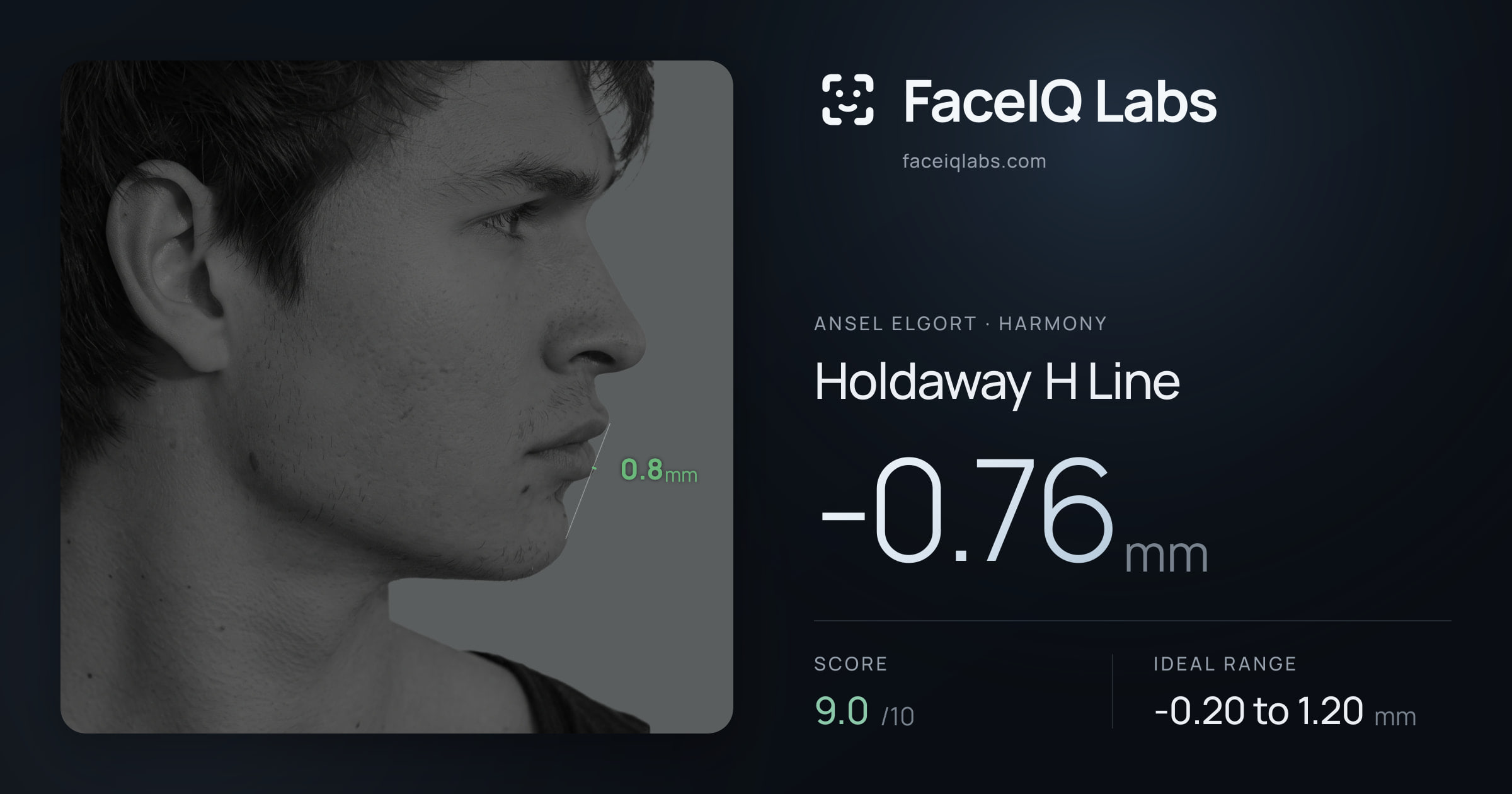 Ansel Elgort Holdaway H Line: -0.76mm, drawn on the photo