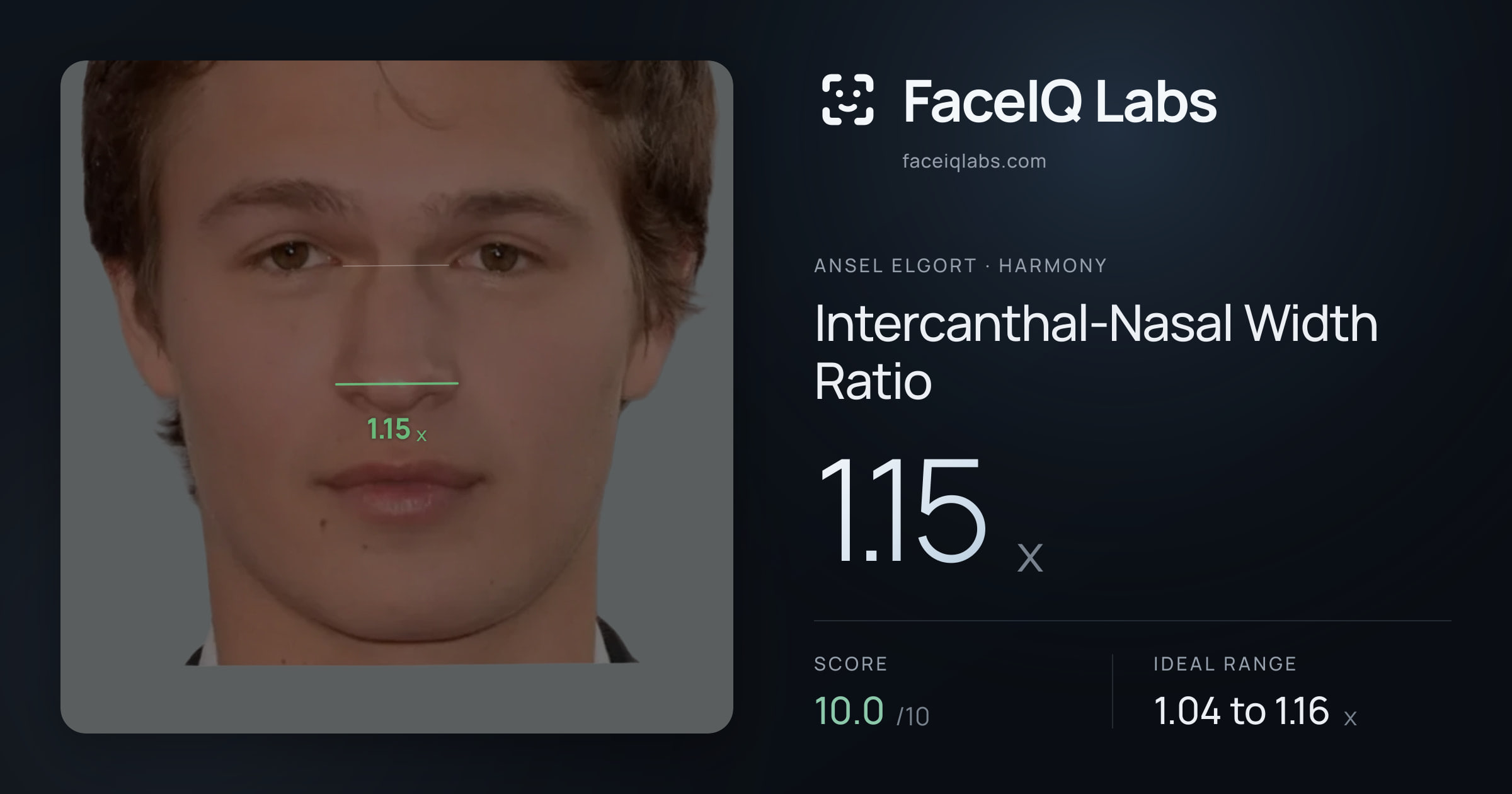 Ansel Elgort Intercanthal-Nasal Width Ratio: 1.15x, drawn on the photo