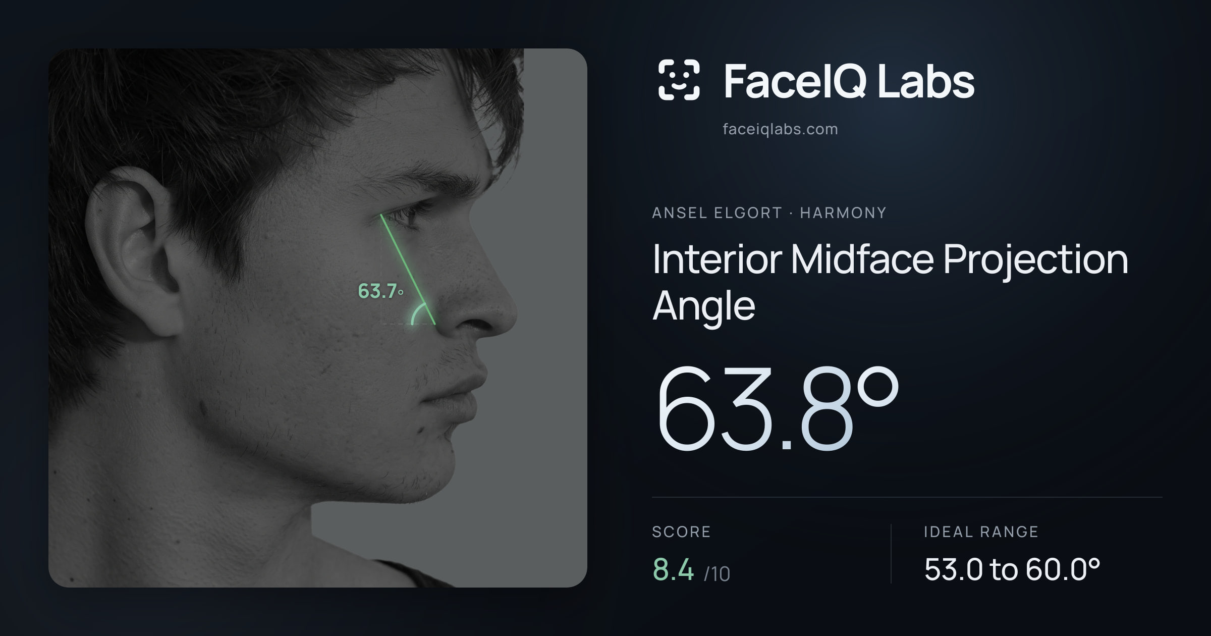 Ansel Elgort Interior Midface Projection Angle: 63.8°, drawn on the photo