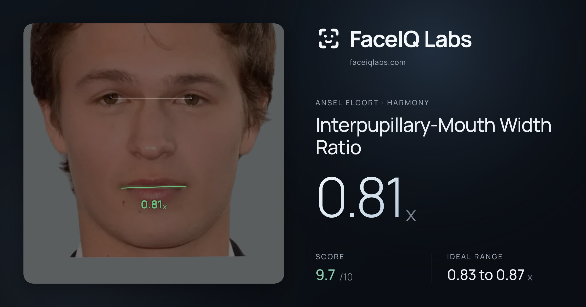 Ansel Elgort Interpupillary-Mouth Width Ratio: 0.81x, drawn on the photo