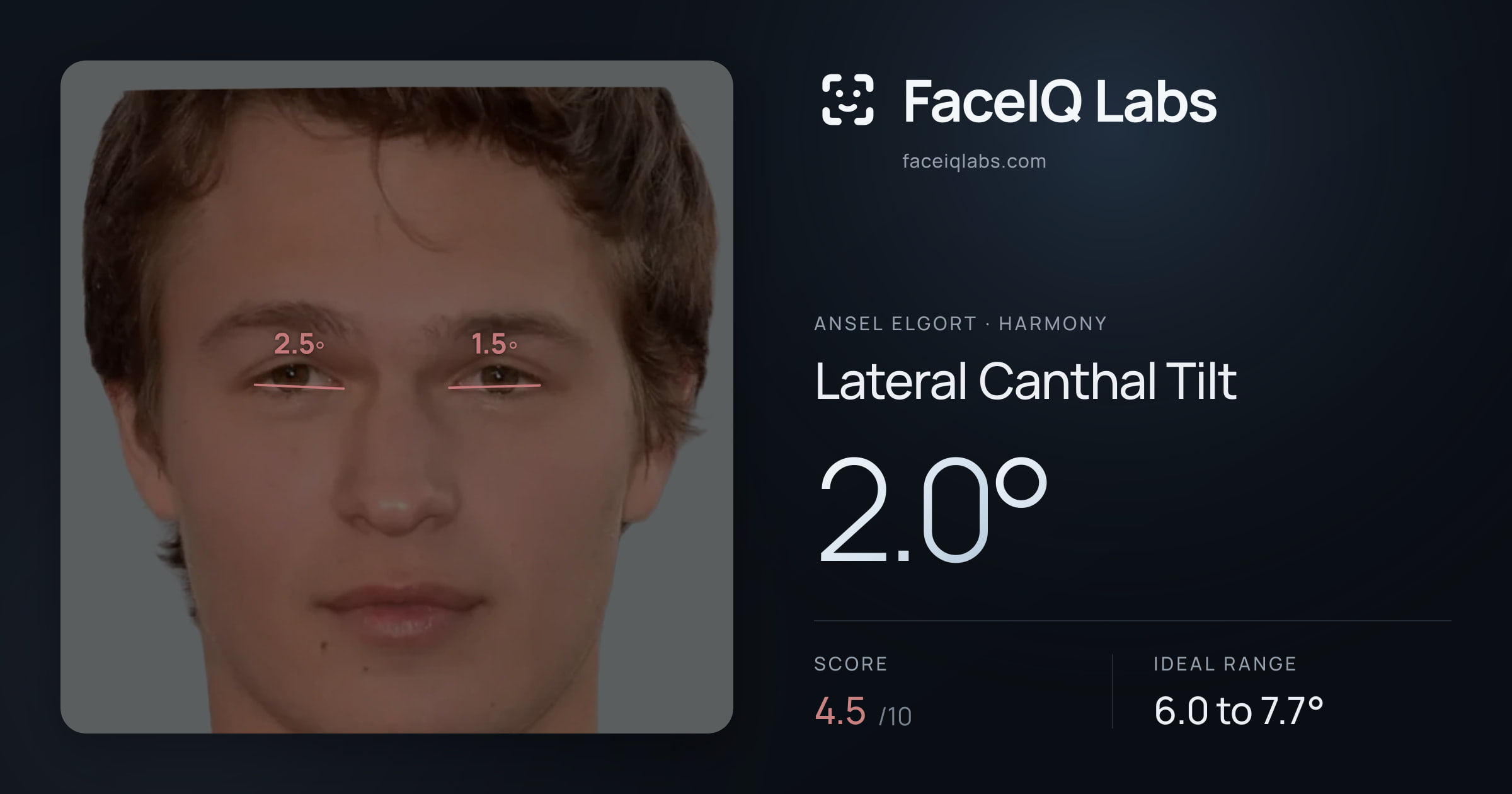 Ansel Elgort Lateral Canthal Tilt: 2.0°, drawn on the photo