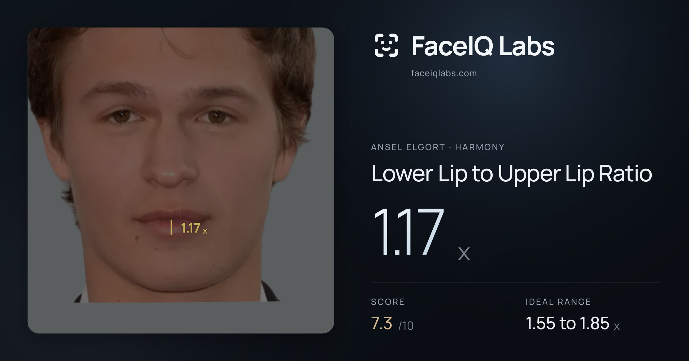 Ansel Elgort Lower Lip to Upper Lip Ratio: 1.17x, drawn on the photo