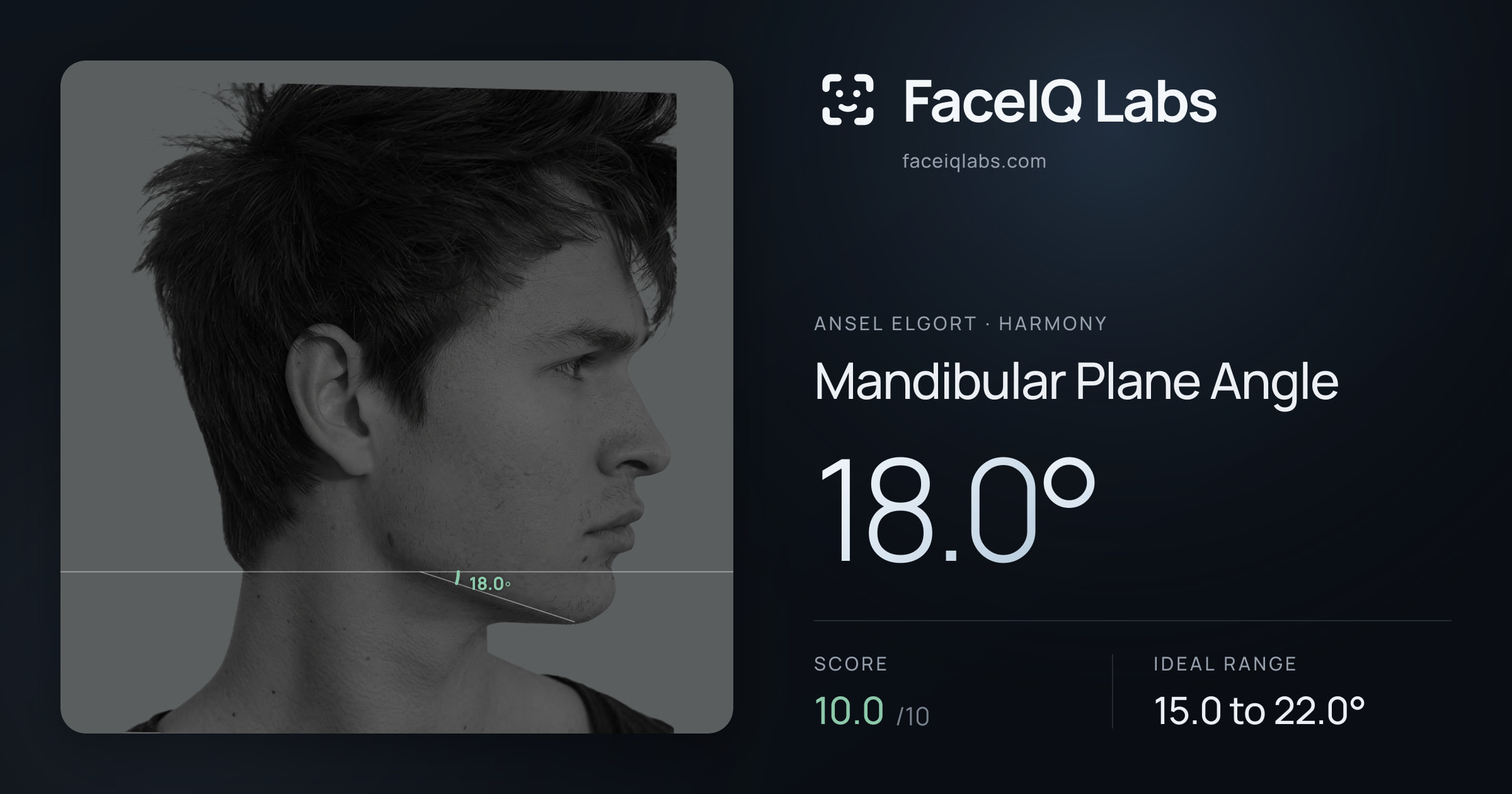 Ansel Elgort Mandibular Plane Angle: 18.0°, drawn on the photo