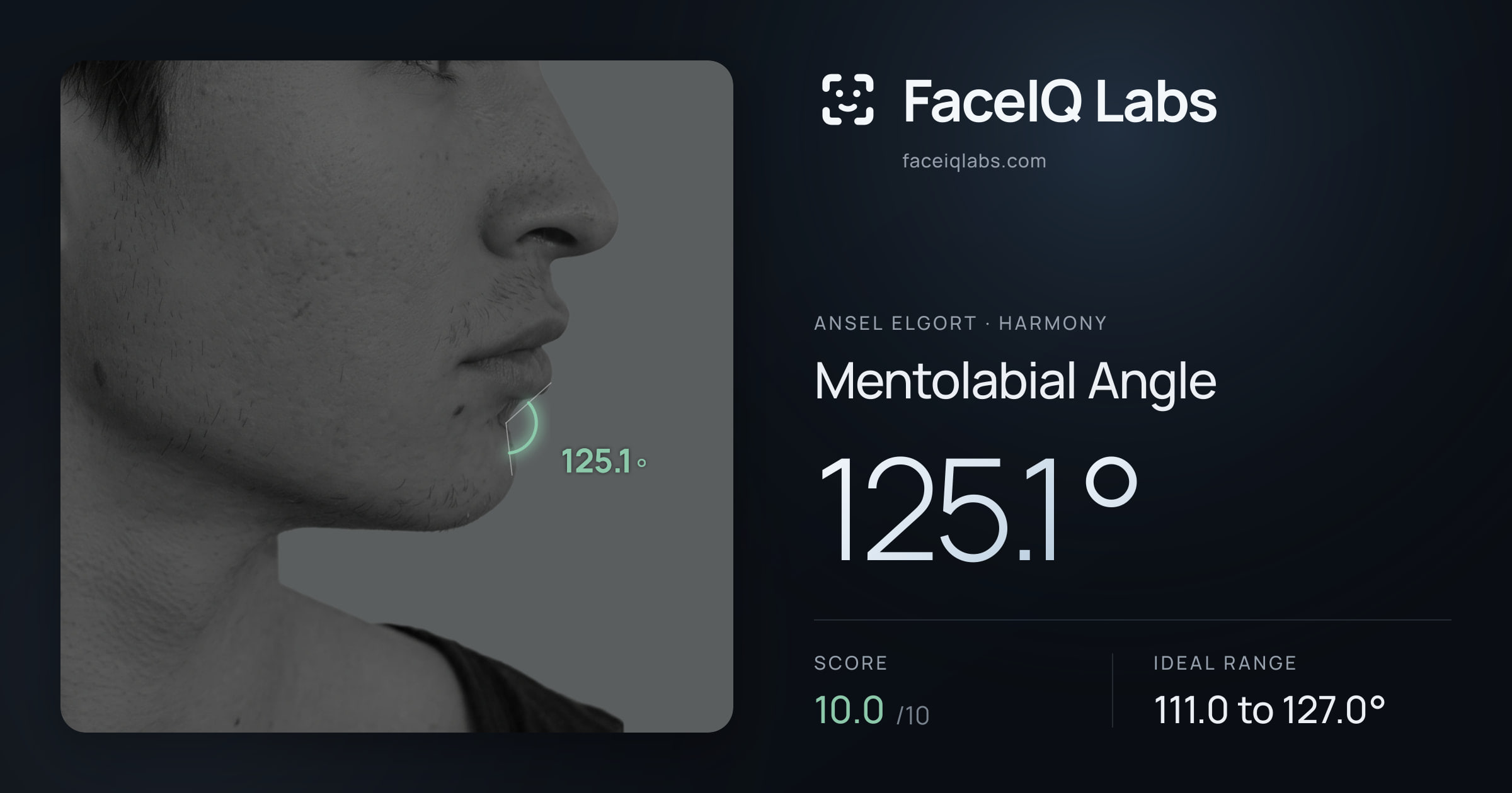 Ansel Elgort Mentolabial Angle: 125.1°, drawn on the photo