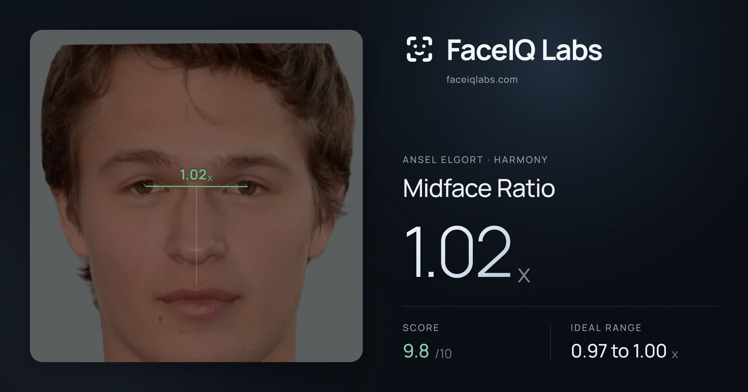 Ansel Elgort Midface Ratio: 1.02x, drawn on the photo