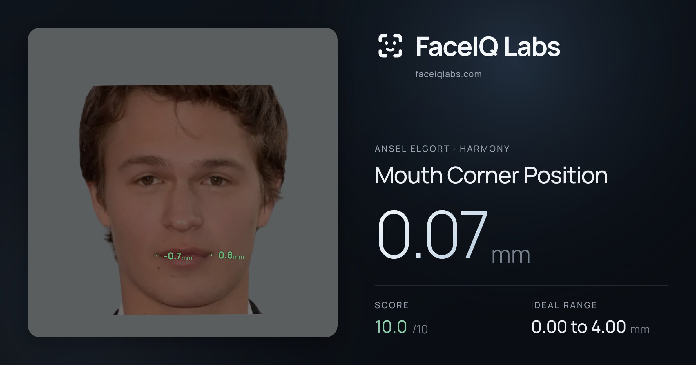 Ansel Elgort Mouth Corner Position: 0.07mm, drawn on the photo