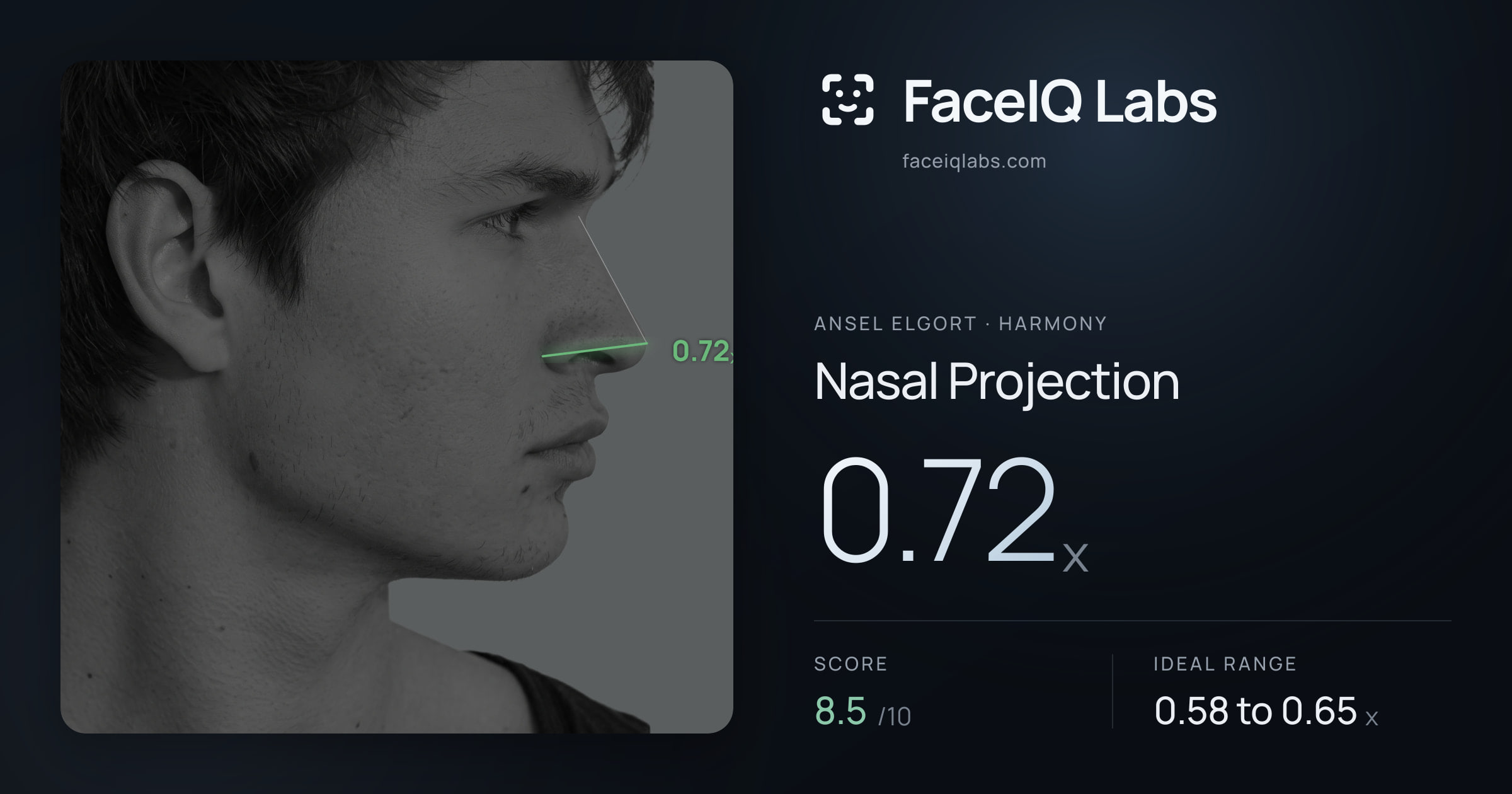 Ansel Elgort Nasal Projection: 0.72x, drawn on the photo
