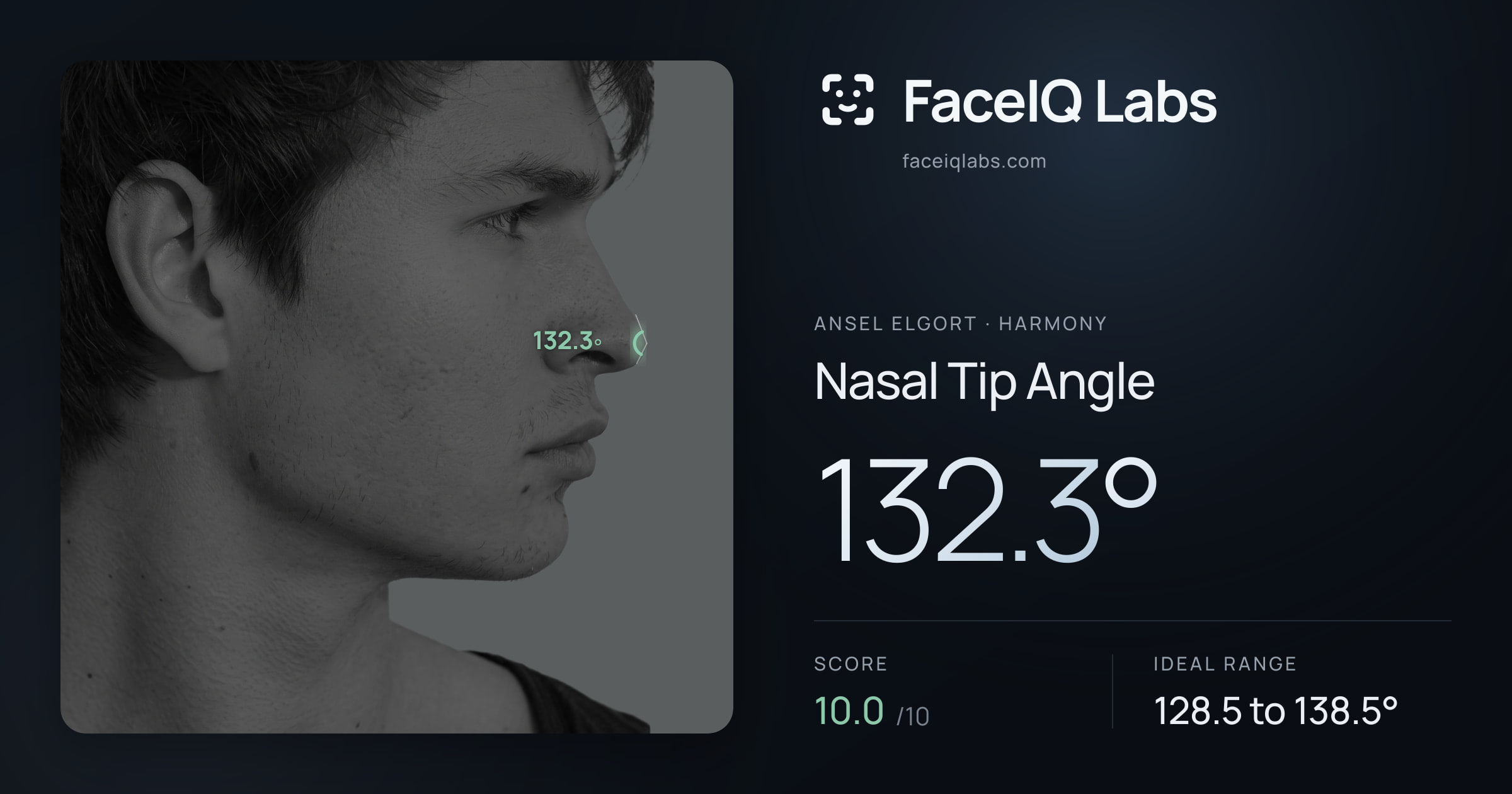Ansel Elgort Nasal Tip Angle: 132.3°, drawn on the photo