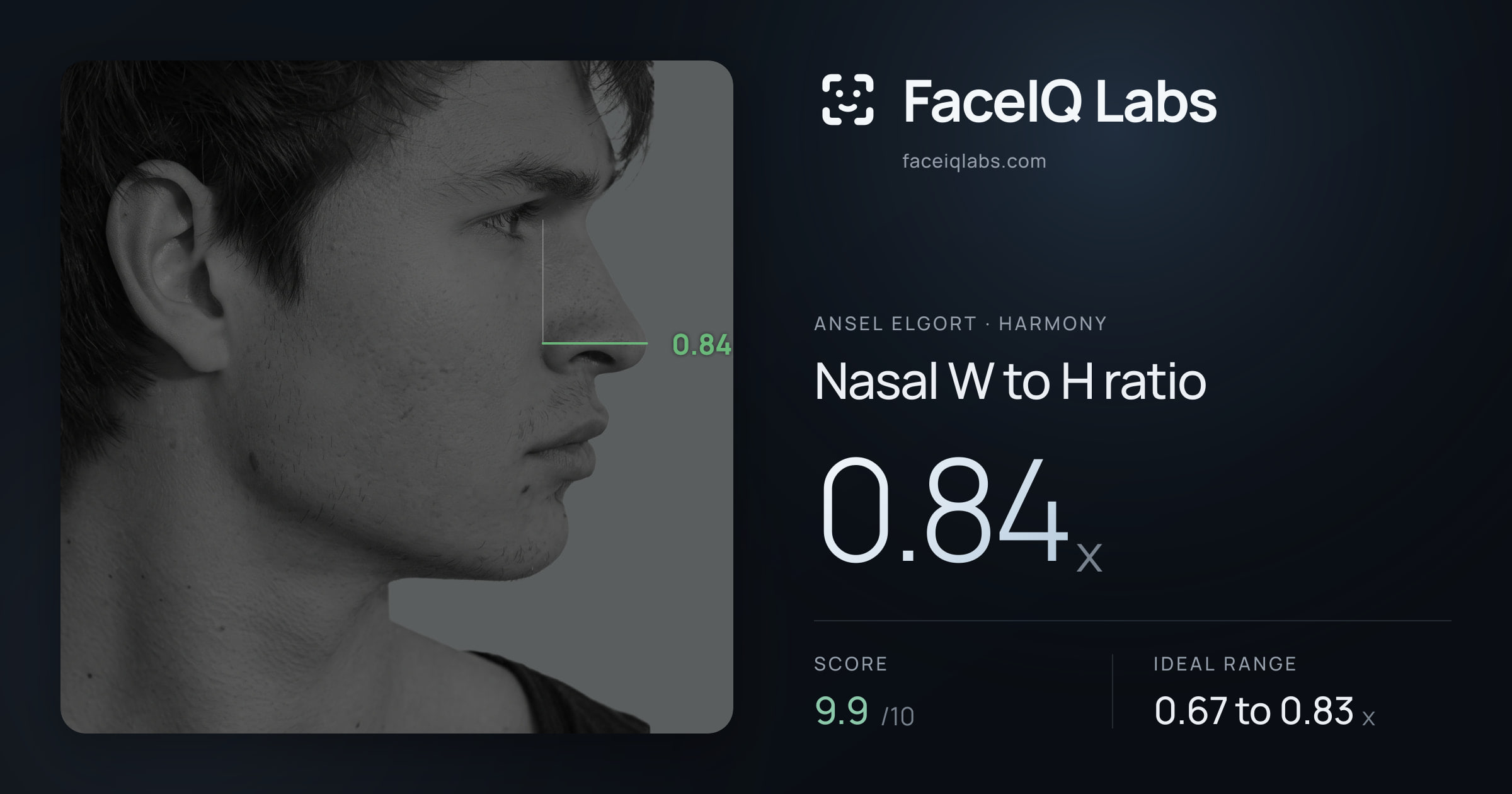 Ansel Elgort Nasal W to H ratio: 0.84x, drawn on the photo
