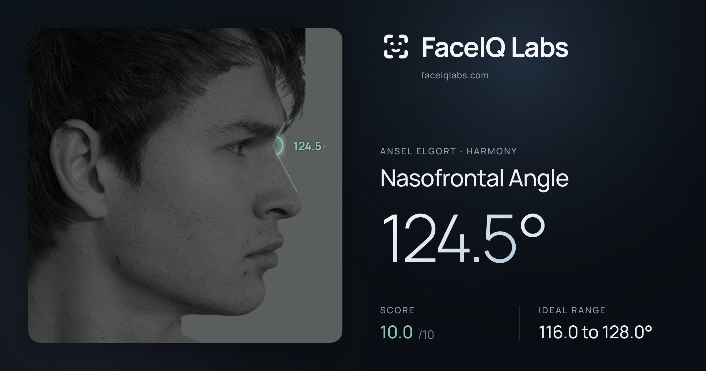 Ansel Elgort Nasofrontal Angle: 124.5°, drawn on the photo