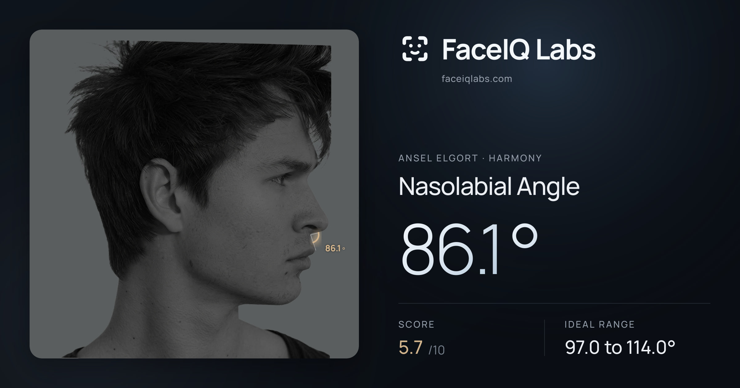 Ansel Elgort Nasolabial Angle: 86.1°, drawn on the photo