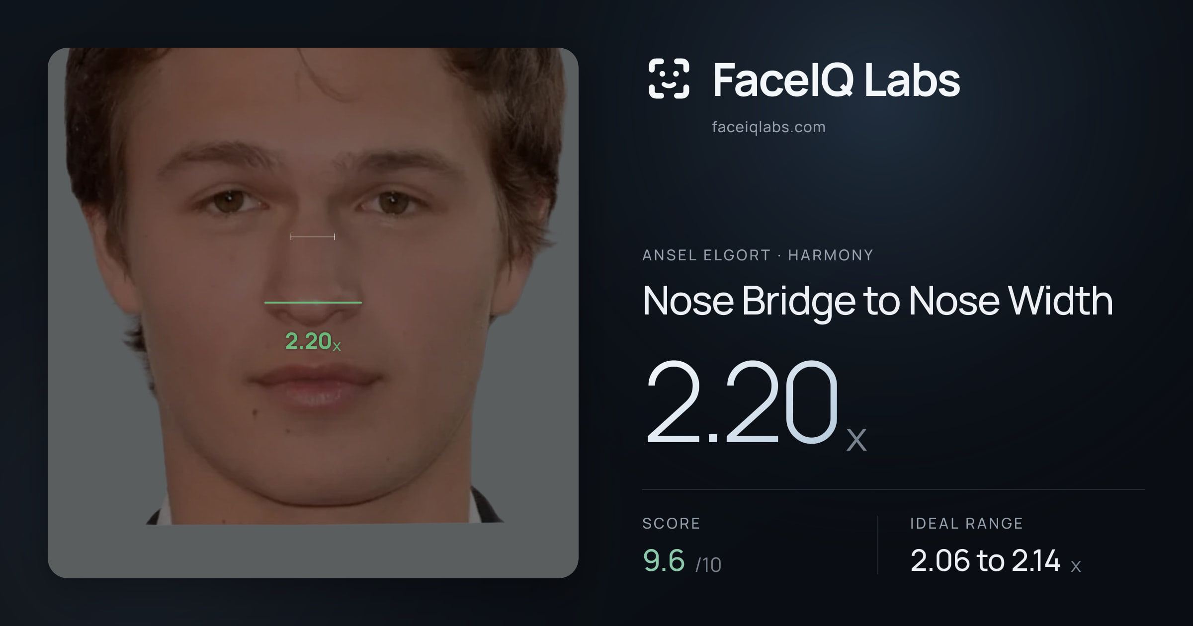 Ansel Elgort Nose Bridge to Nose Width: 2.20x, drawn on the photo