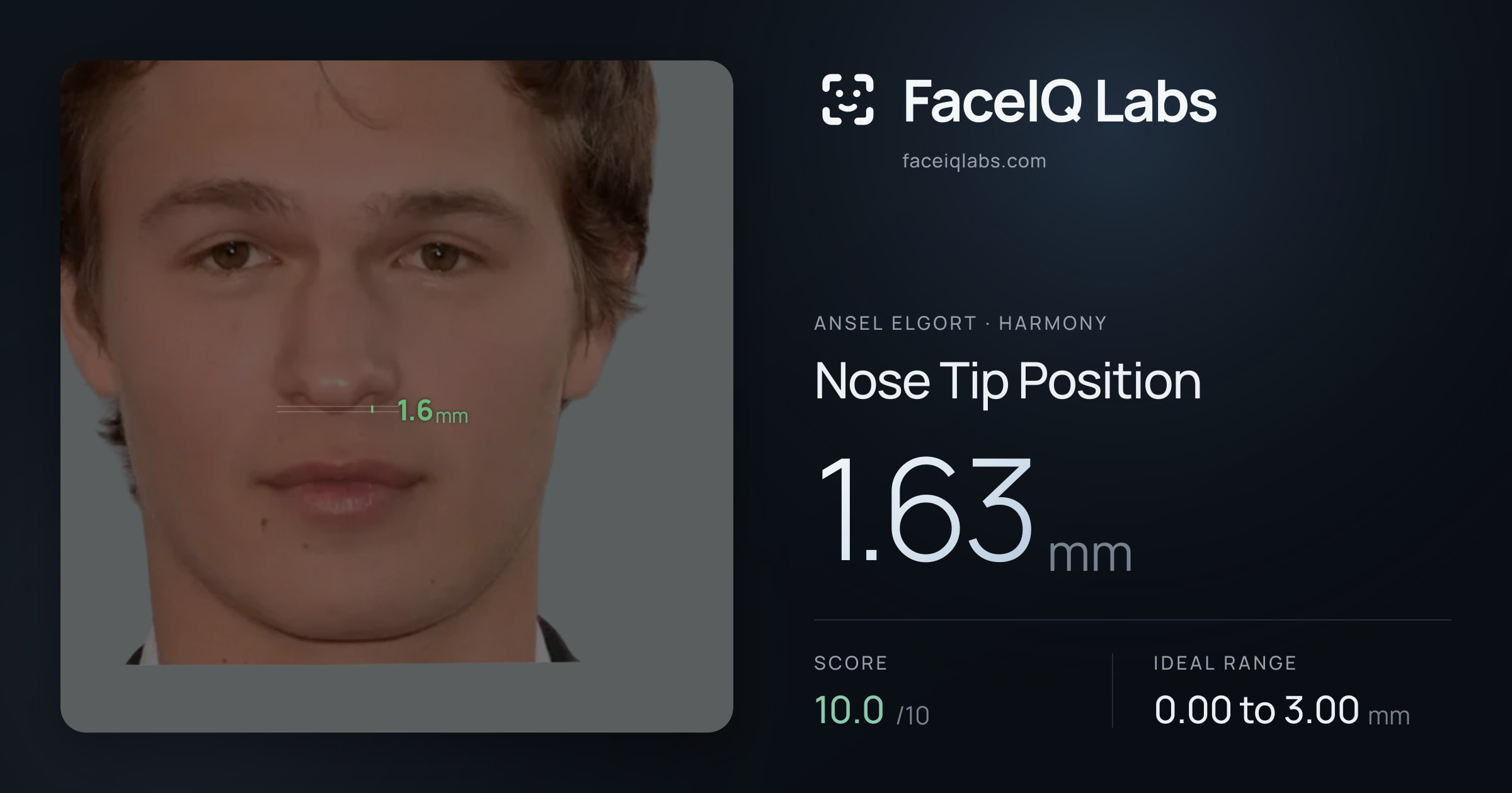Ansel Elgort Nose Tip Position: 1.63mm, drawn on the photo