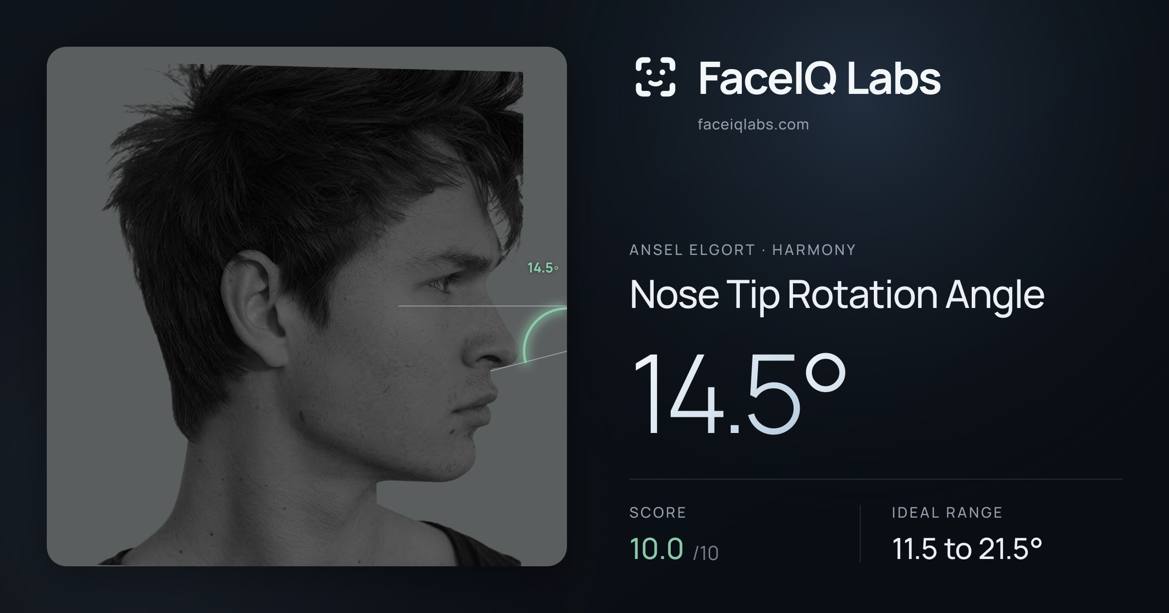 Ansel Elgort Nose Tip Rotation Angle: 14.5°, drawn on the photo