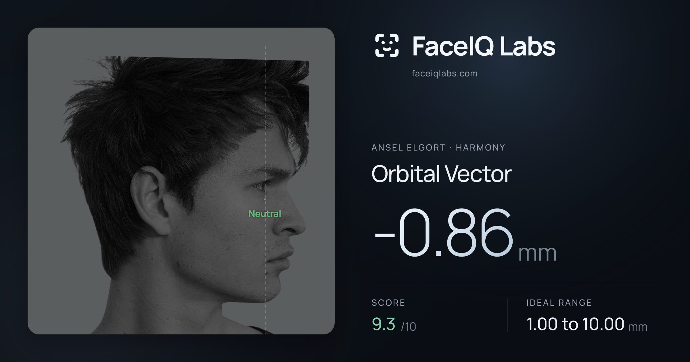 Ansel Elgort Orbital Vector: -0.86mm, drawn on the photo
