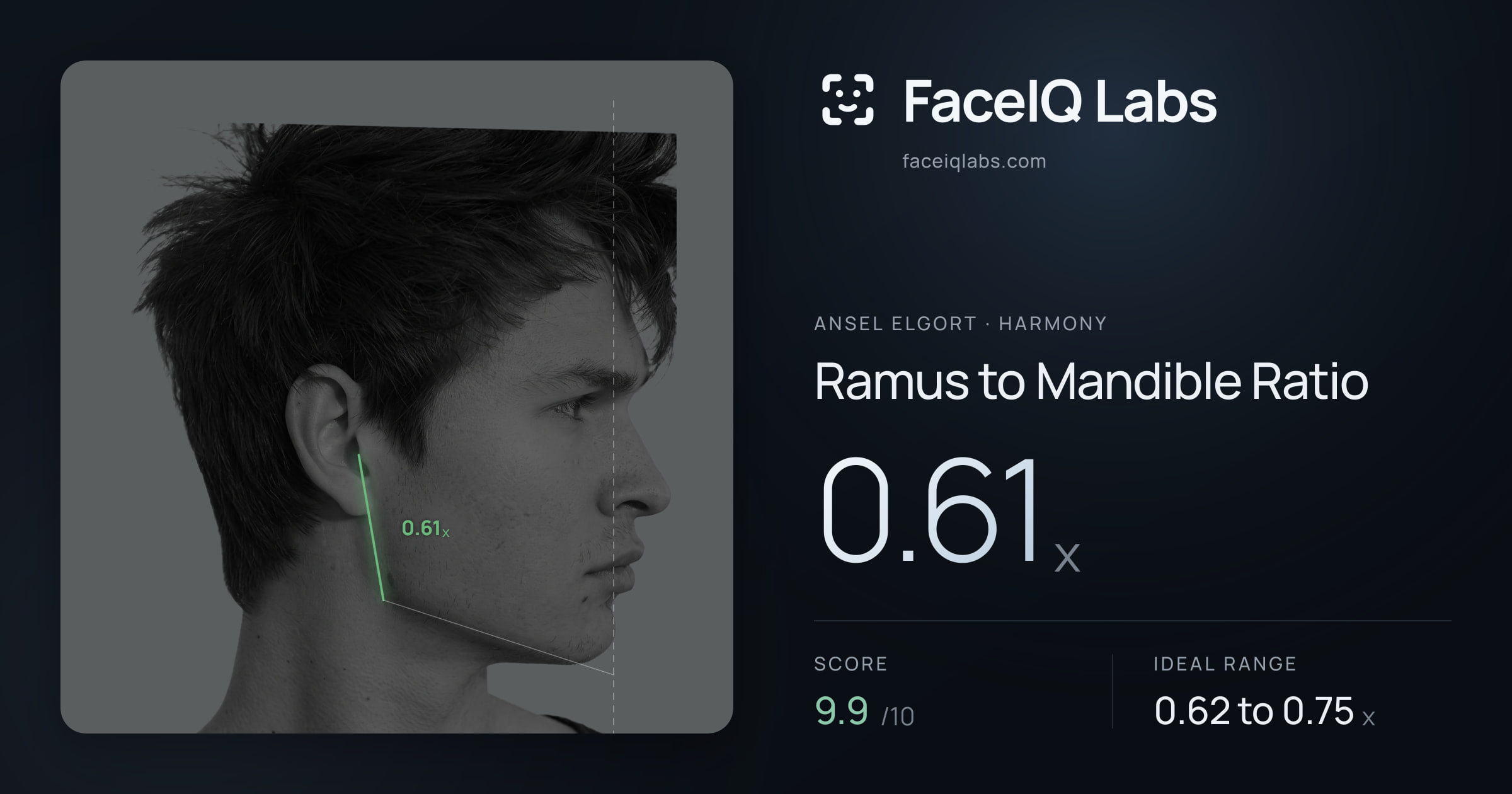 Ansel Elgort Ramus to Mandible Ratio: 0.61x, drawn on the photo