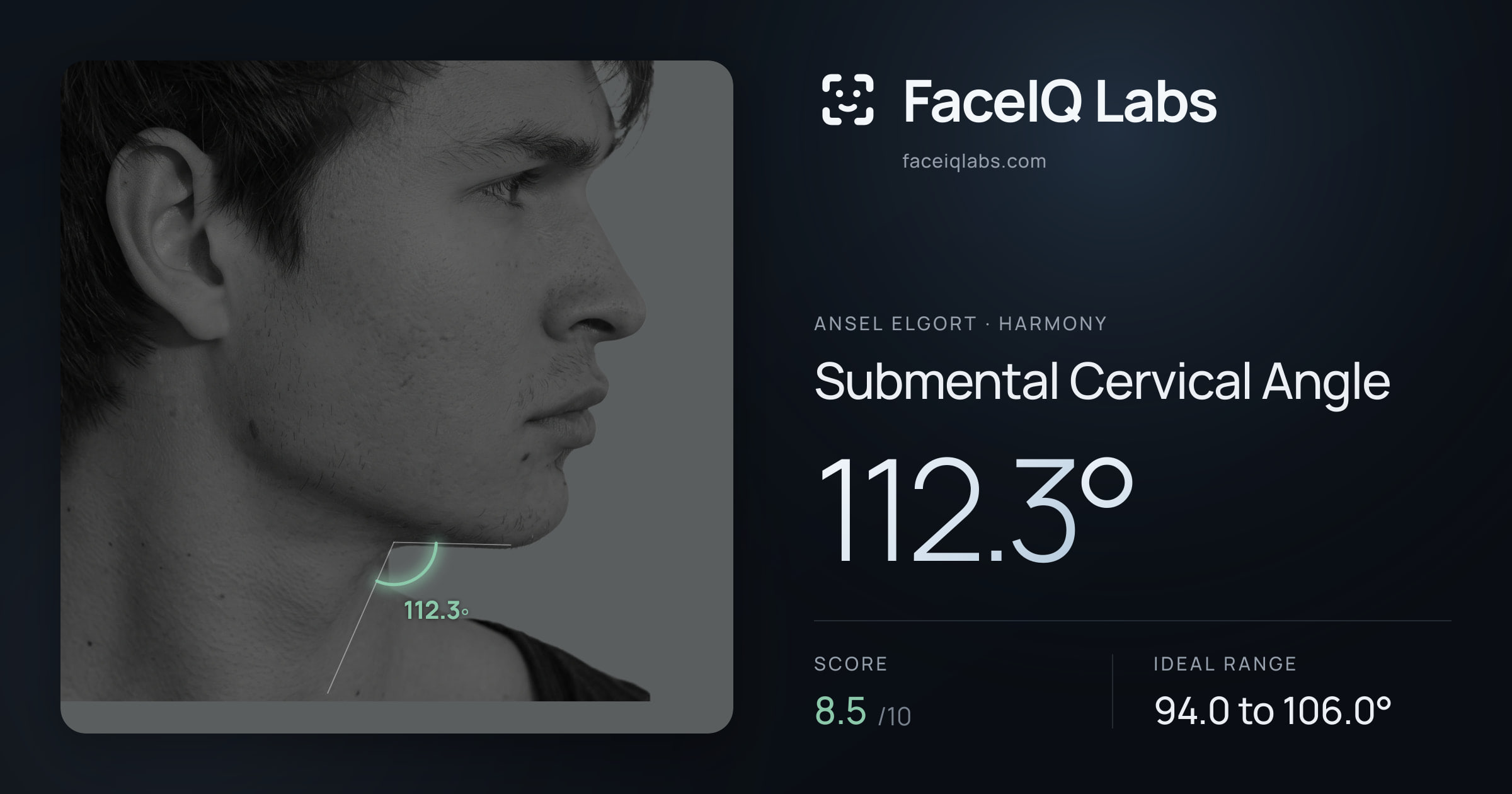 Ansel Elgort Submental Cervical Angle: 112.3°, drawn on the photo