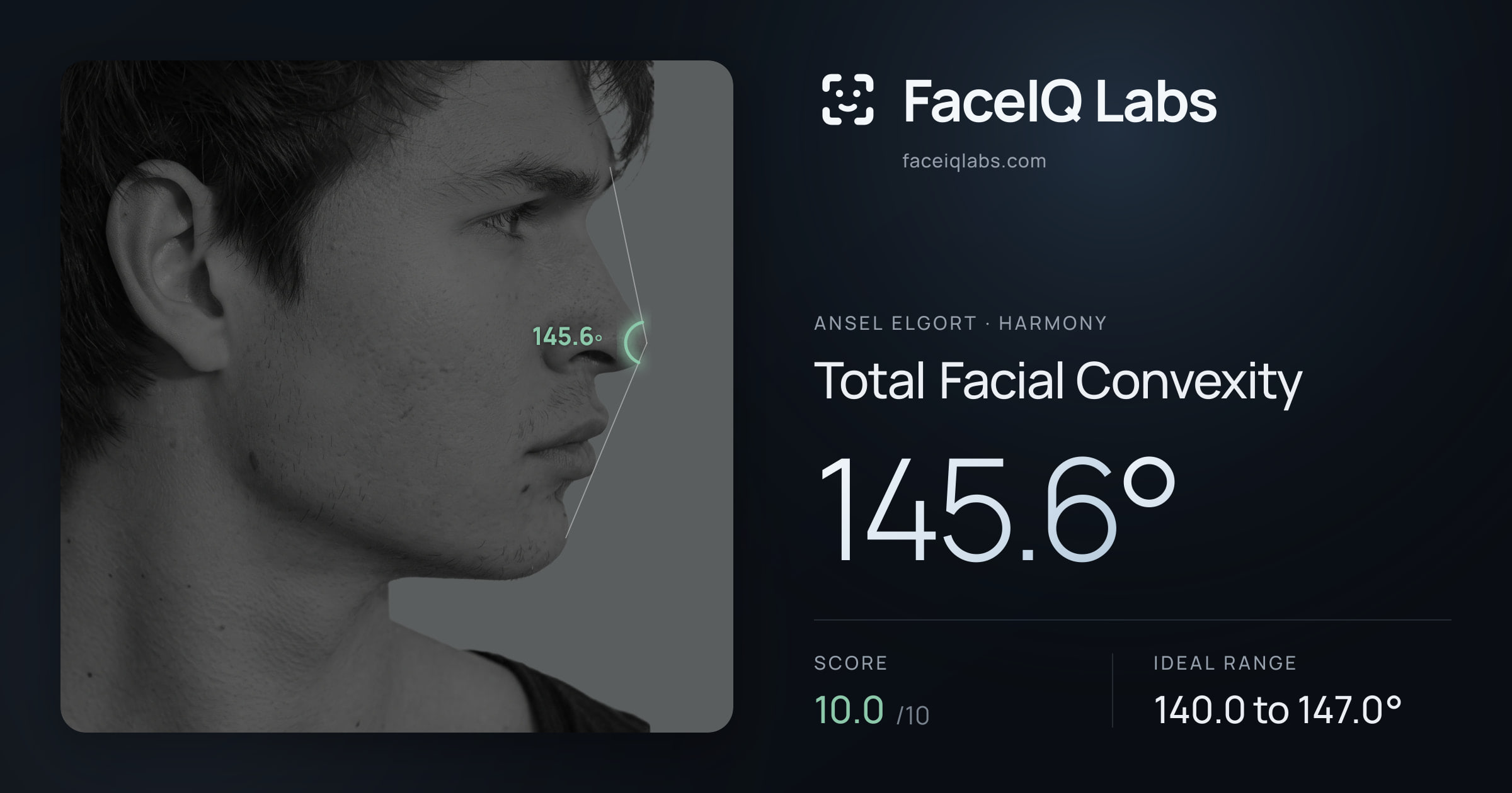 Ansel Elgort Total Facial Convexity: 145.6°, drawn on the photo