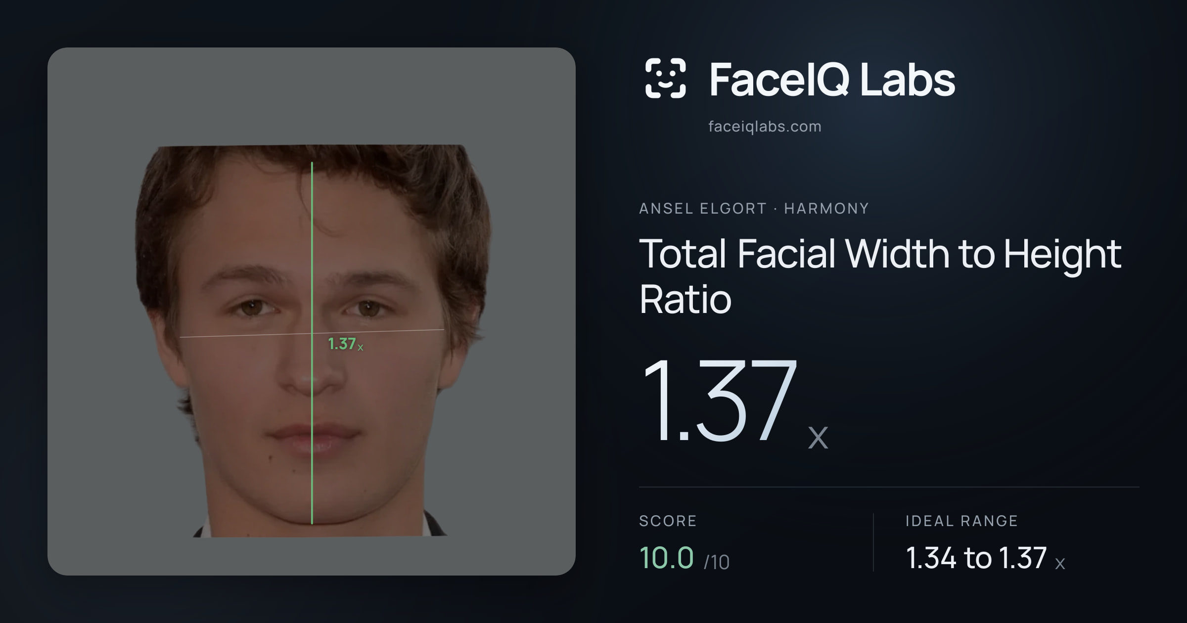 Ansel Elgort Total Facial Width to Height Ratio: 1.37x, drawn on the photo