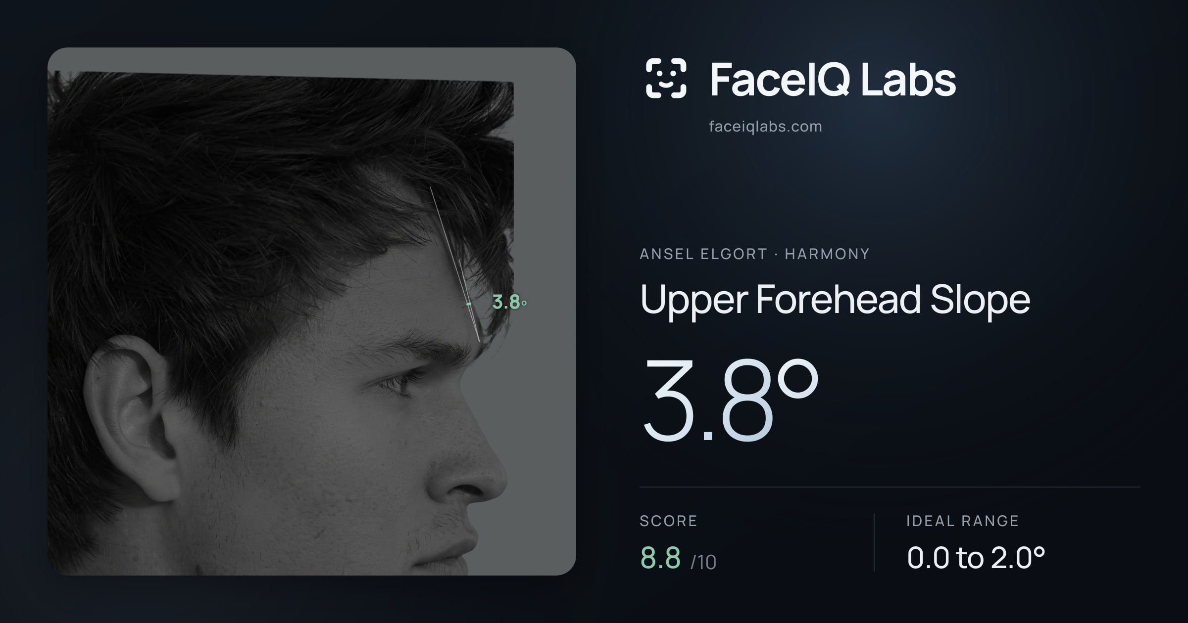Ansel Elgort Upper Forehead Slope: 3.8°, drawn on the photo