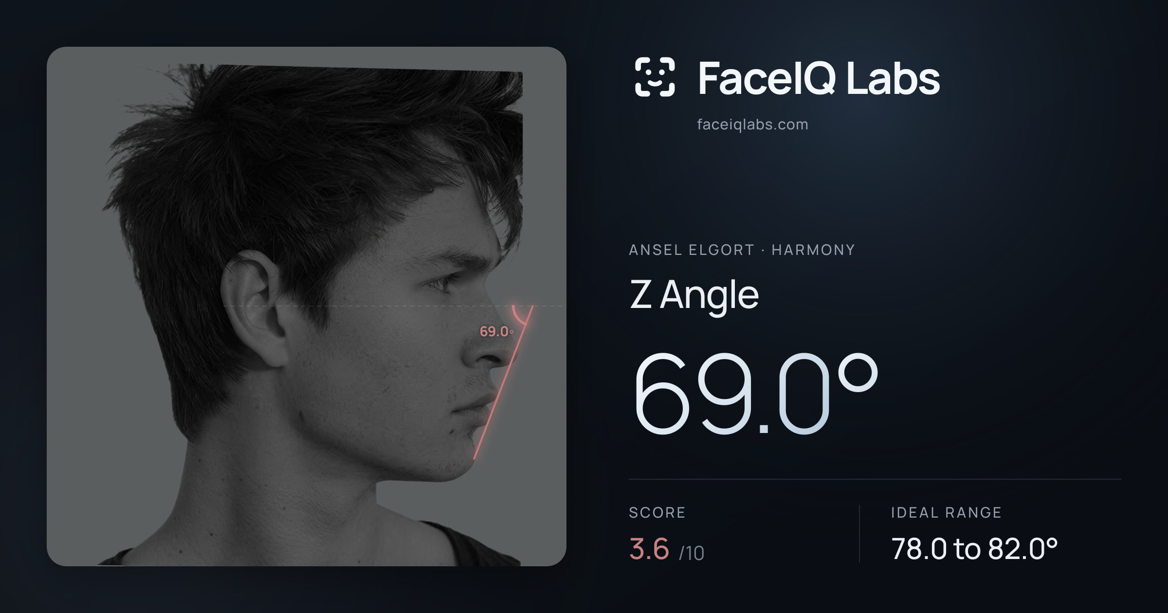 Ansel Elgort Z Angle: 69.0°, drawn on the photo