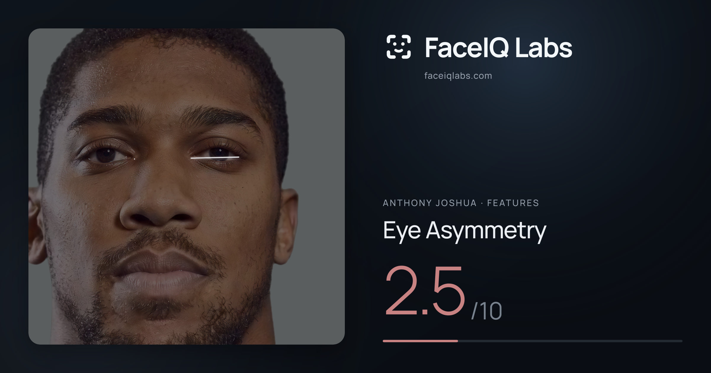 Anthony Joshua Eye Asymmetry: 2.5/10, drawn on the photo